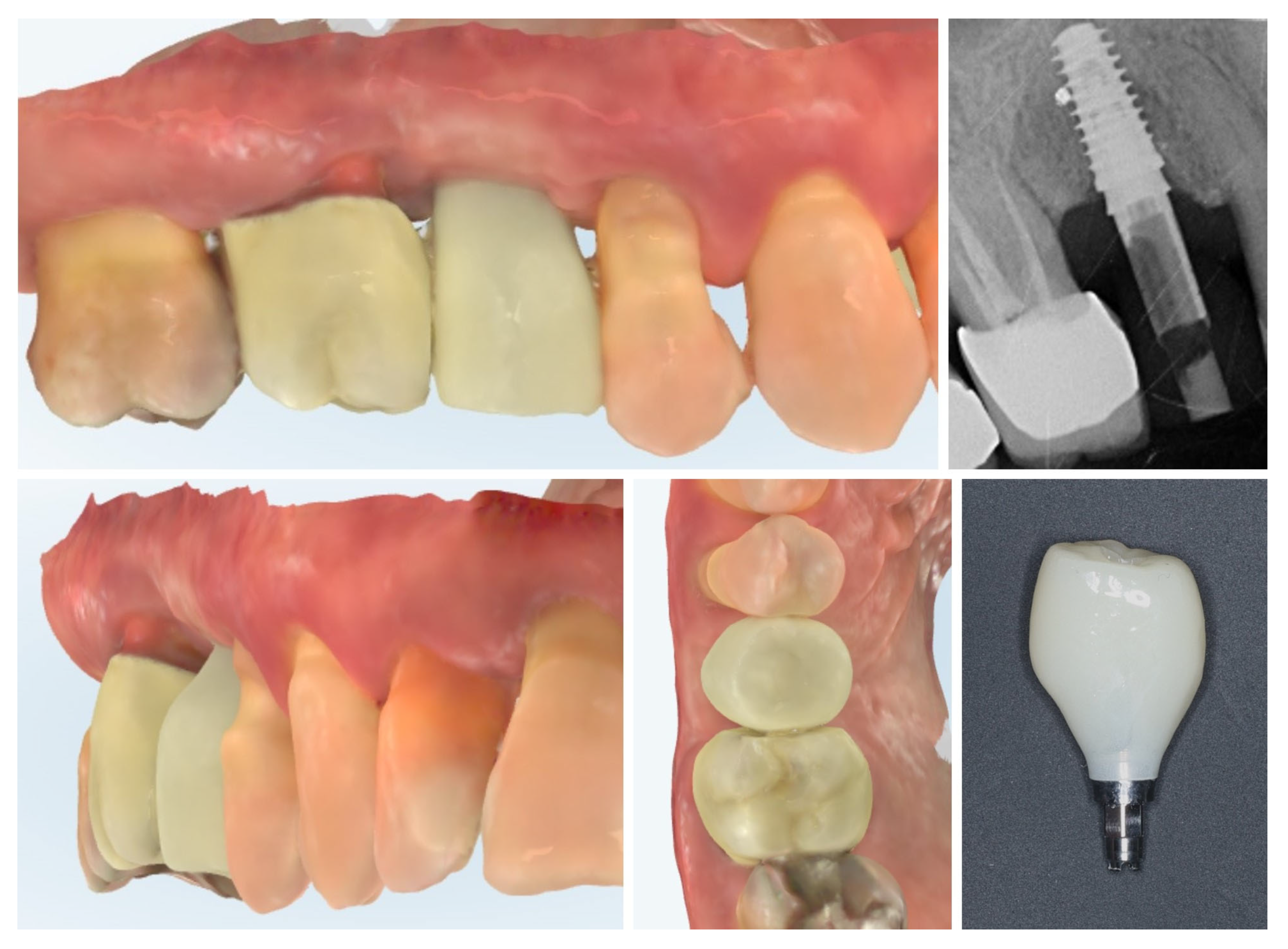 Dentistry 13 00483 g013