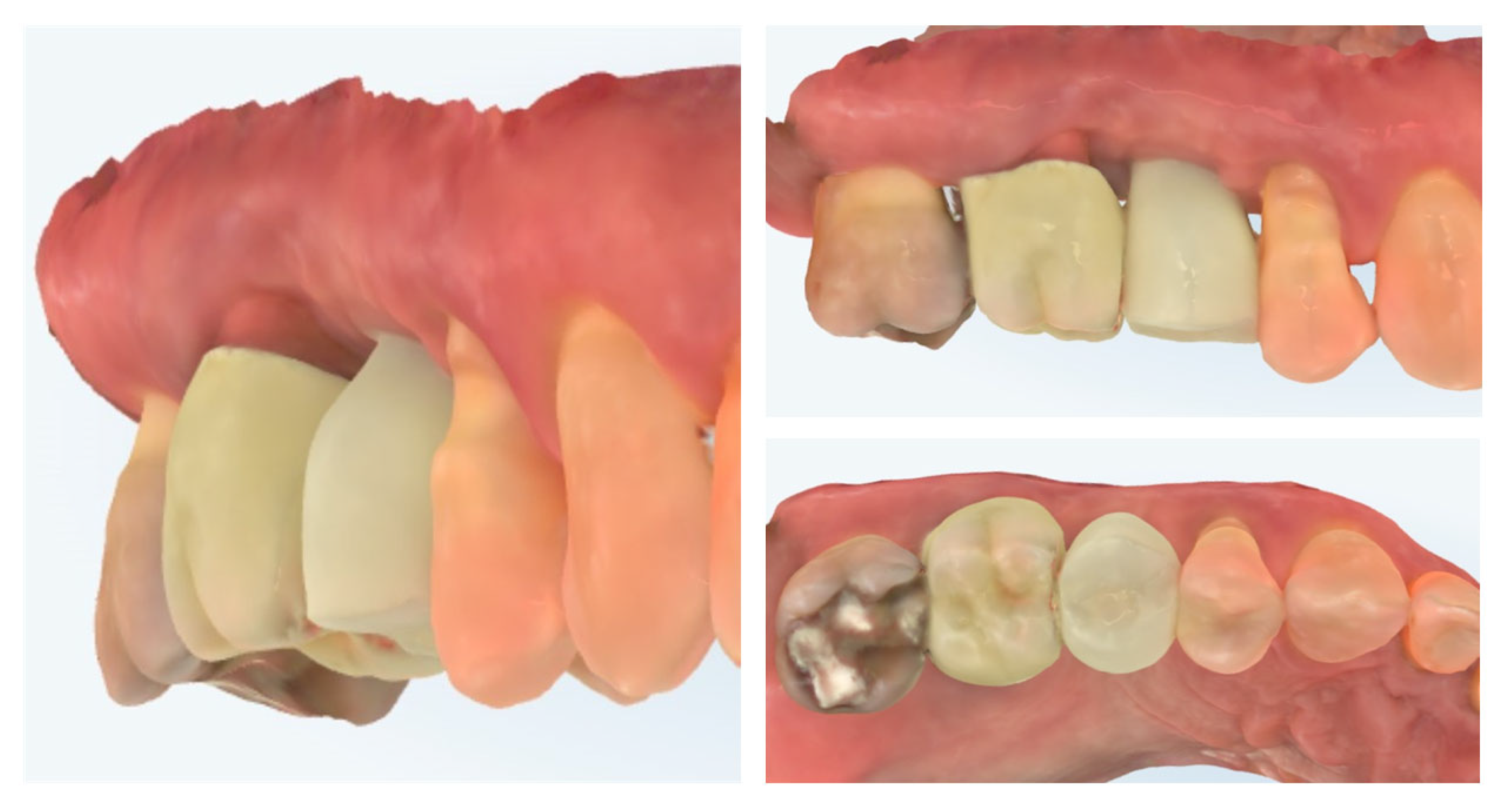 Dentistry 13 00483 g014