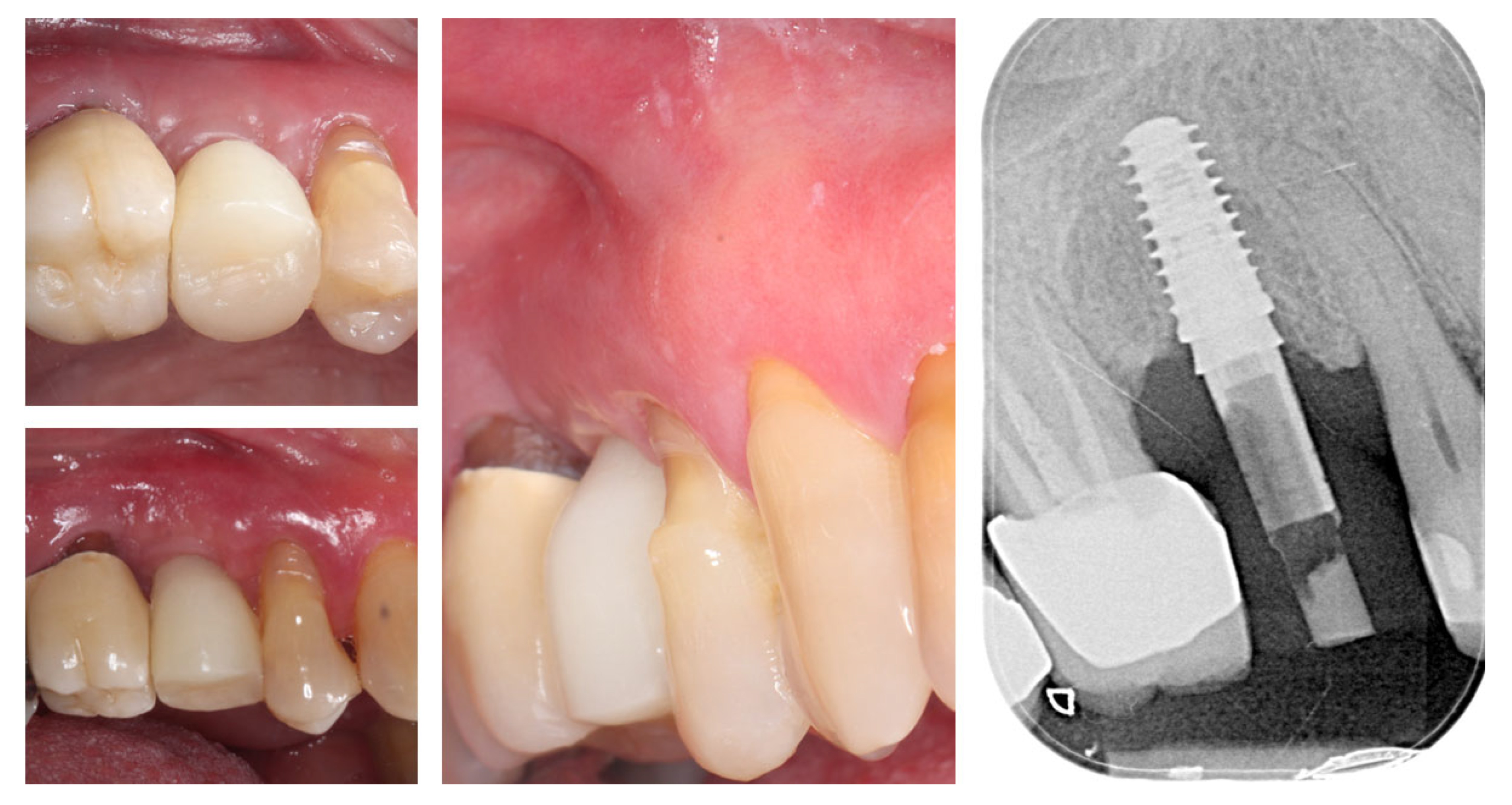 Dentistry 13 00483 g015
