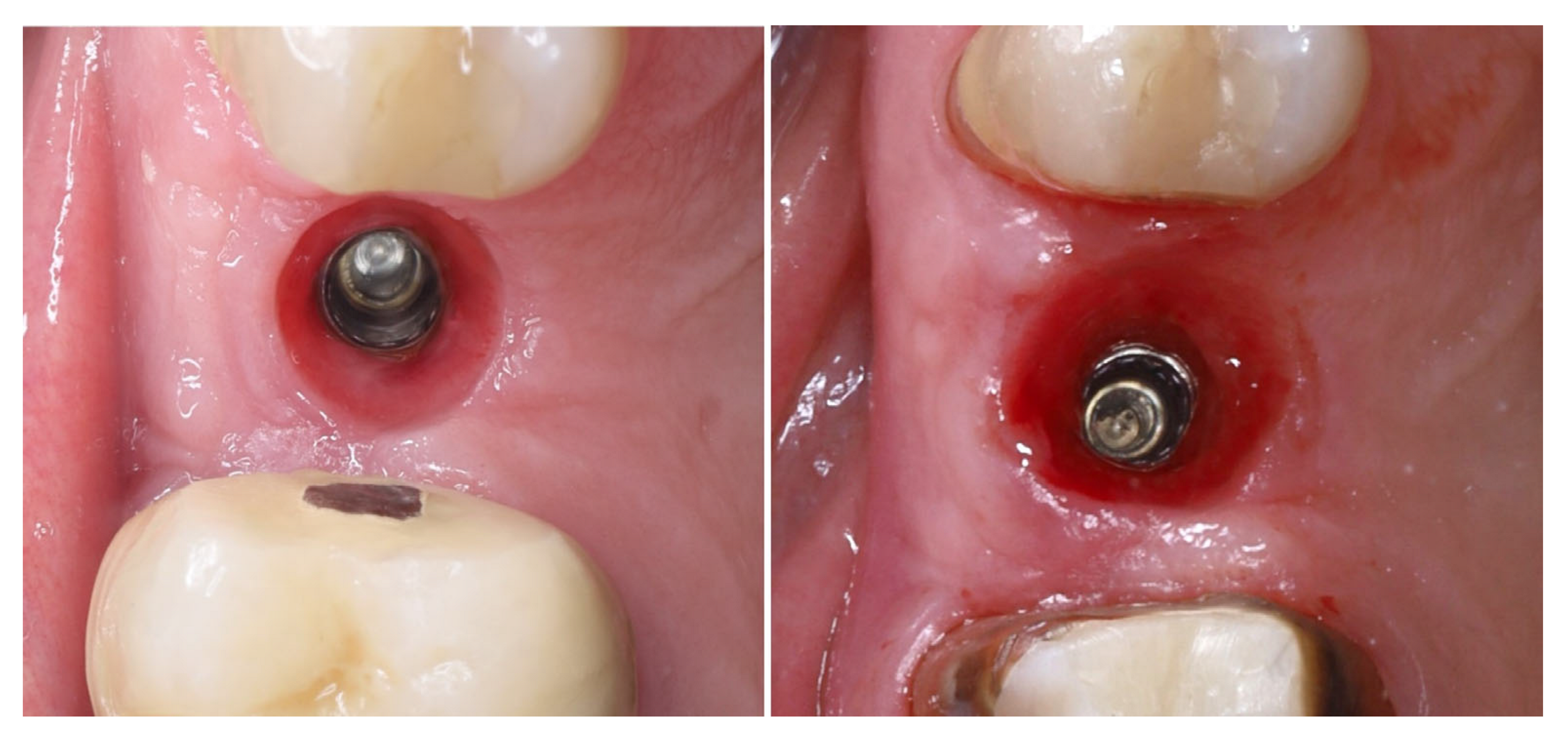 Dentistry 13 00483 g016