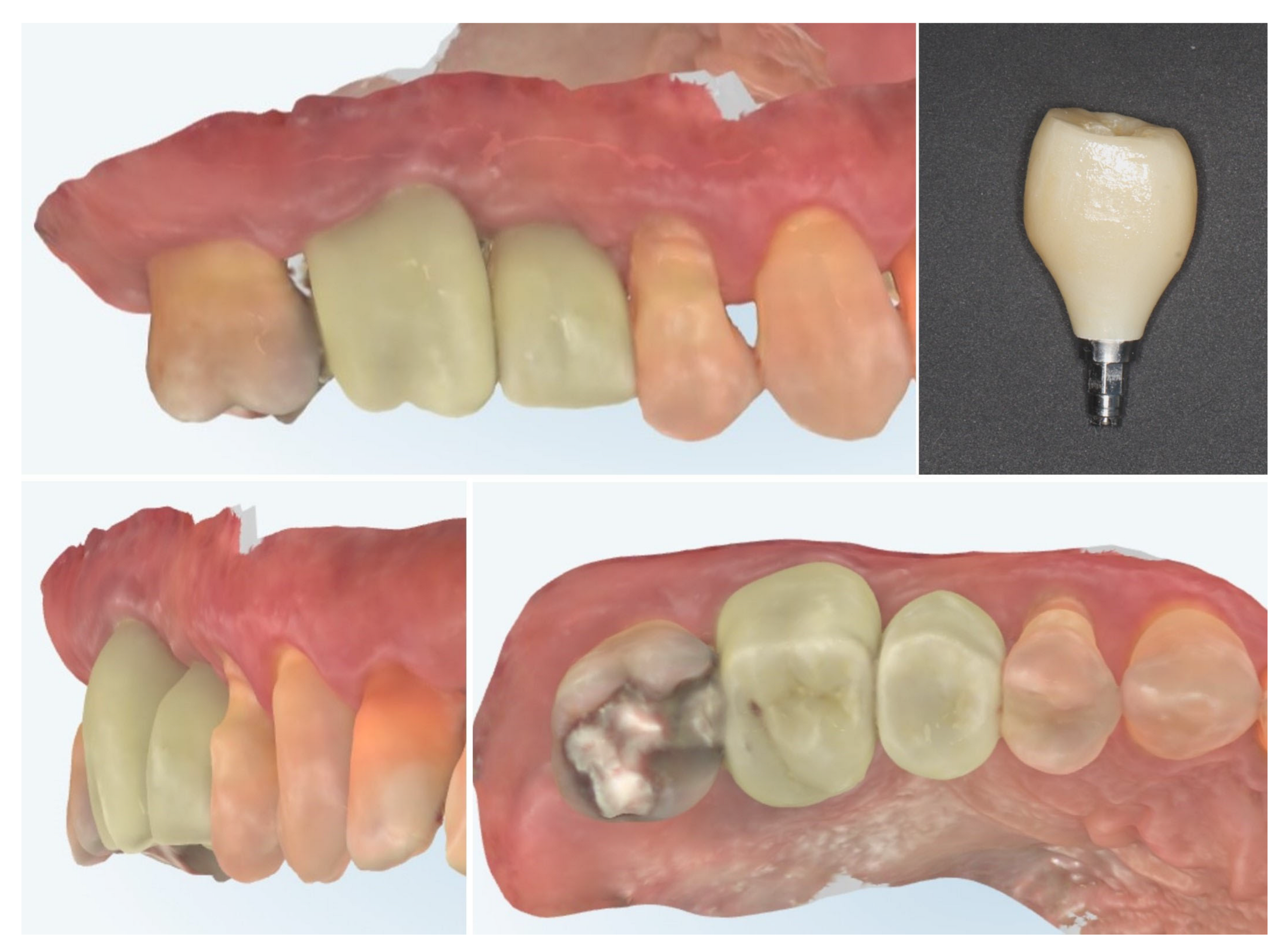 Dentistry 13 00483 g017