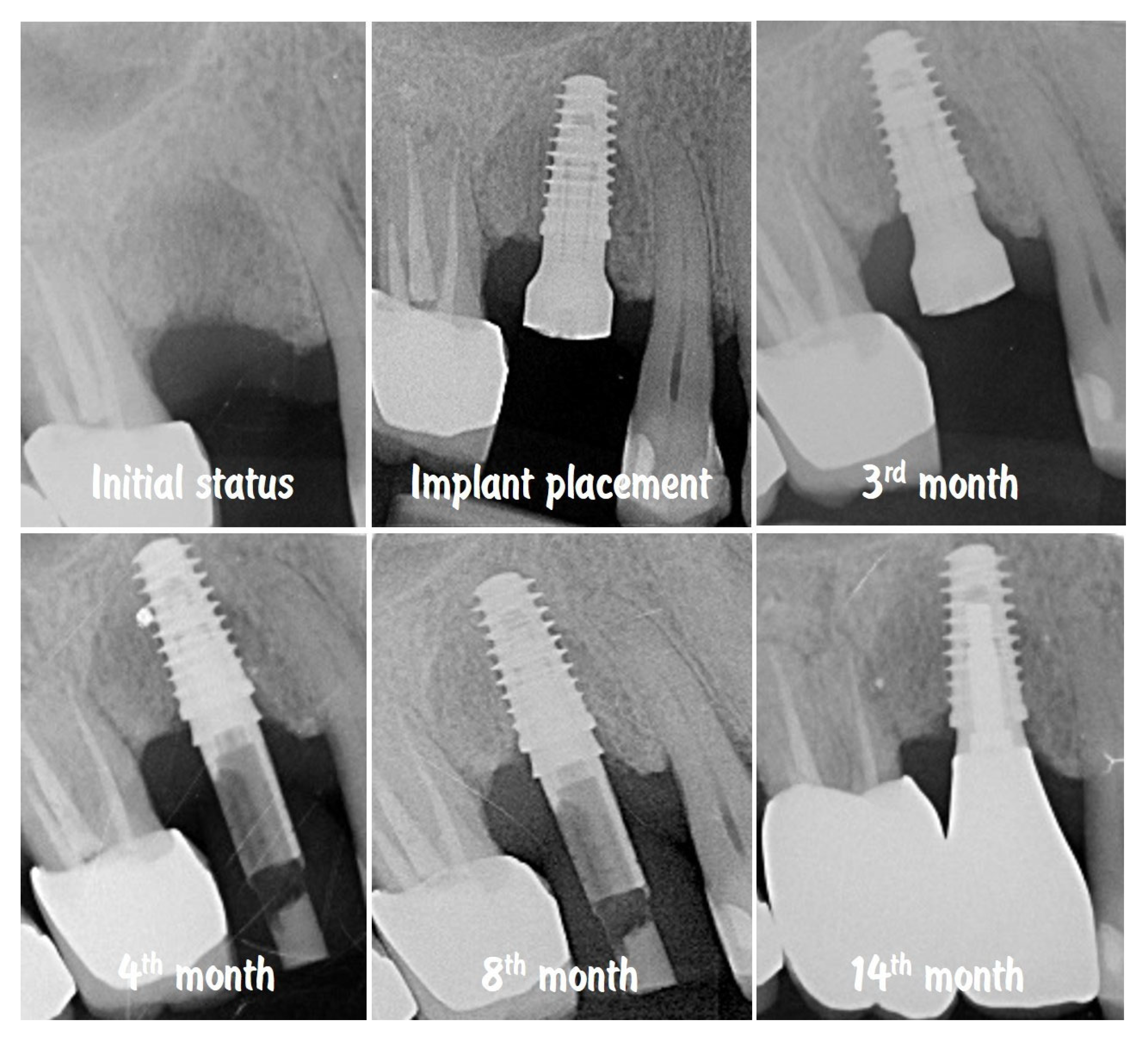 Dentistry 13 00483 g019