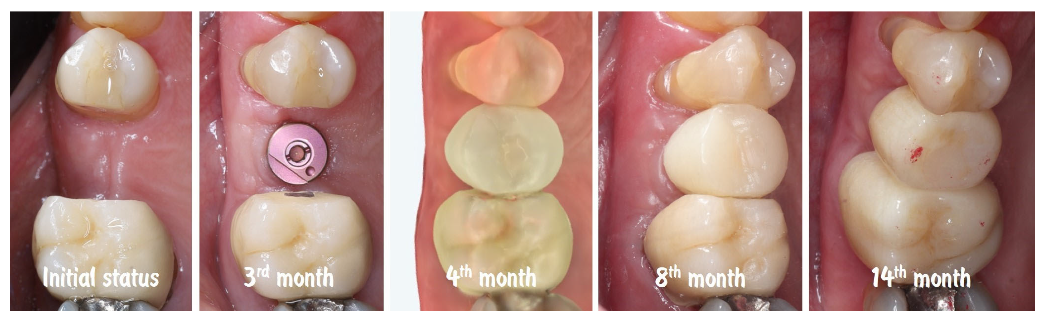 Dentistry 13 00483 g020