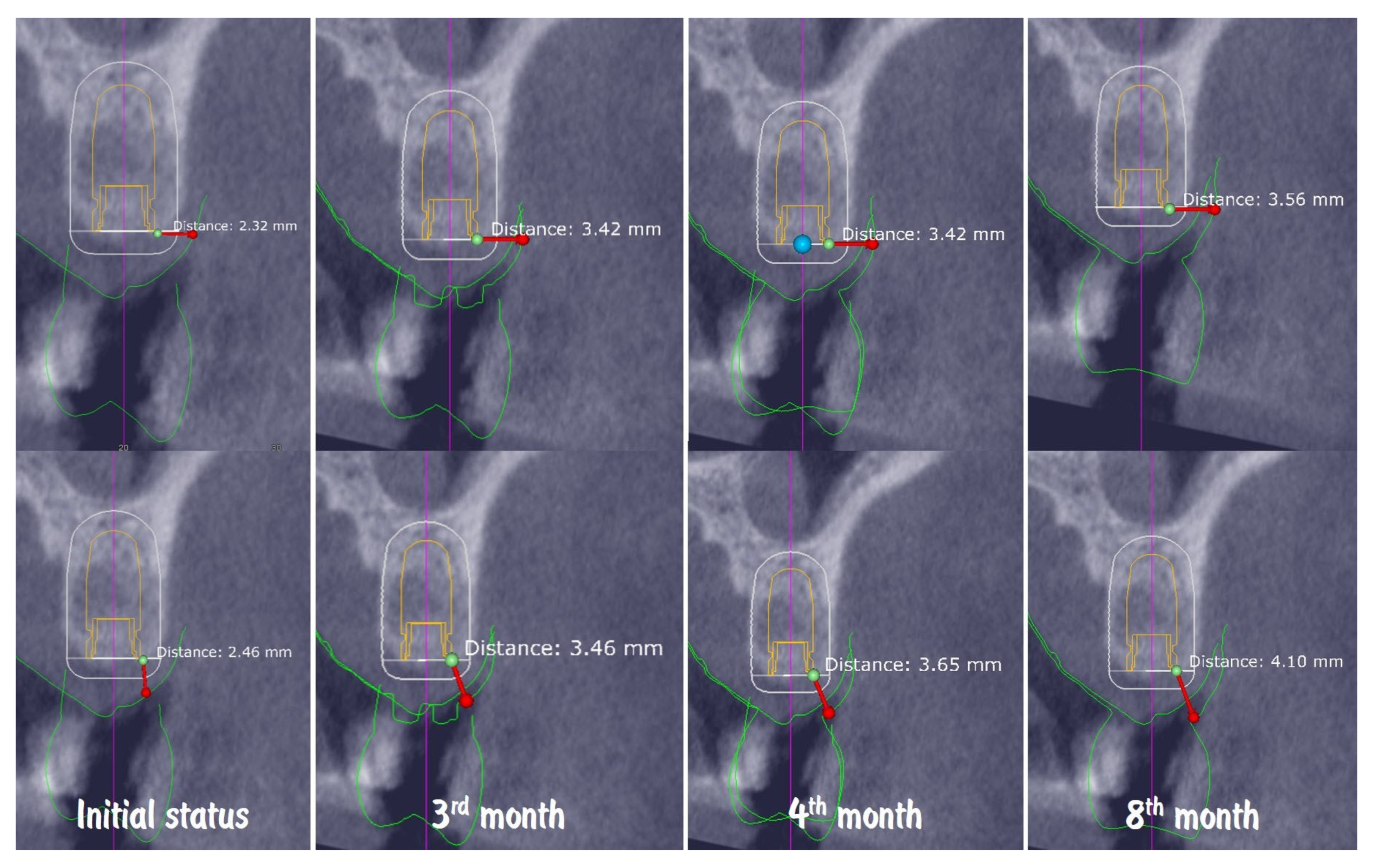 Dentistry 13 00483 g021