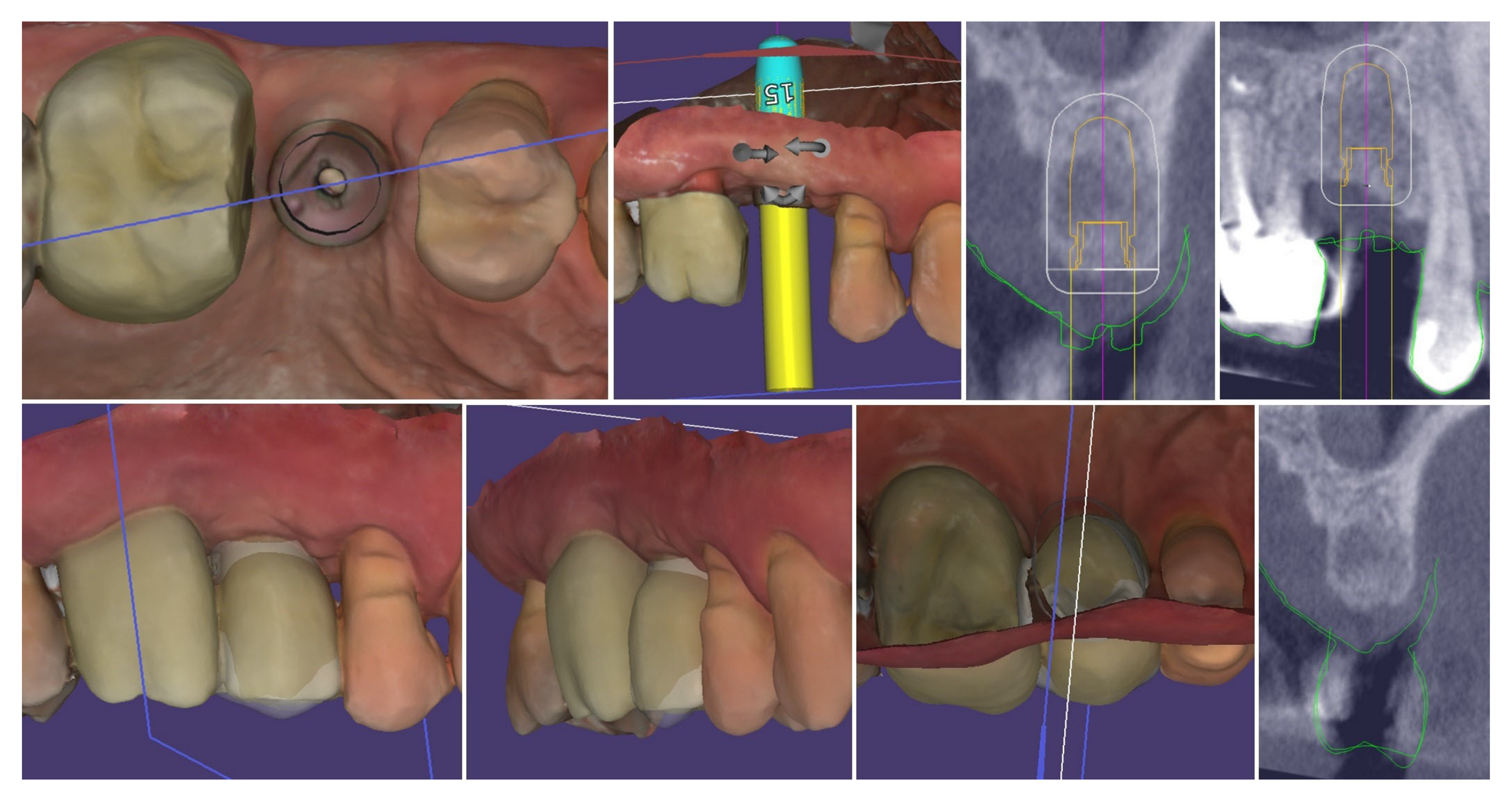 Dentistry 13 00483 g022