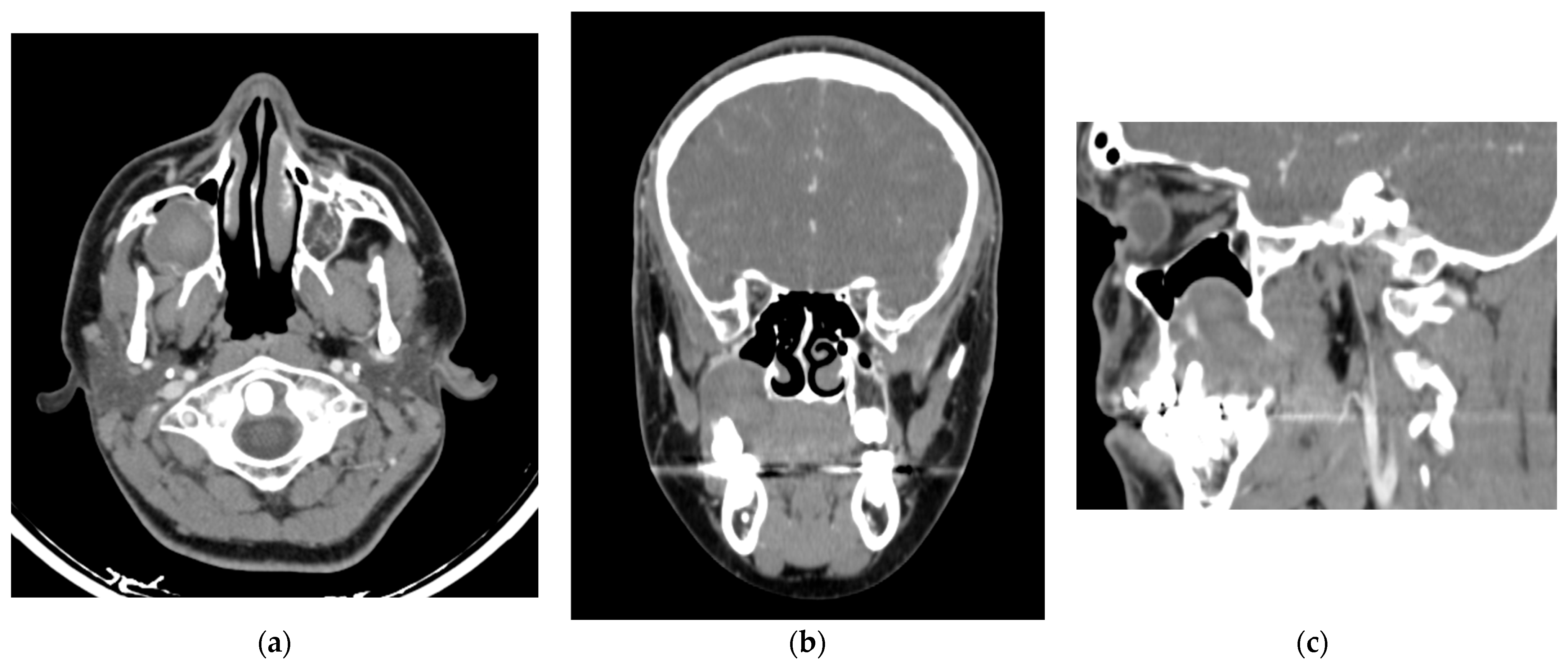 Dentistry 13 00491 g002