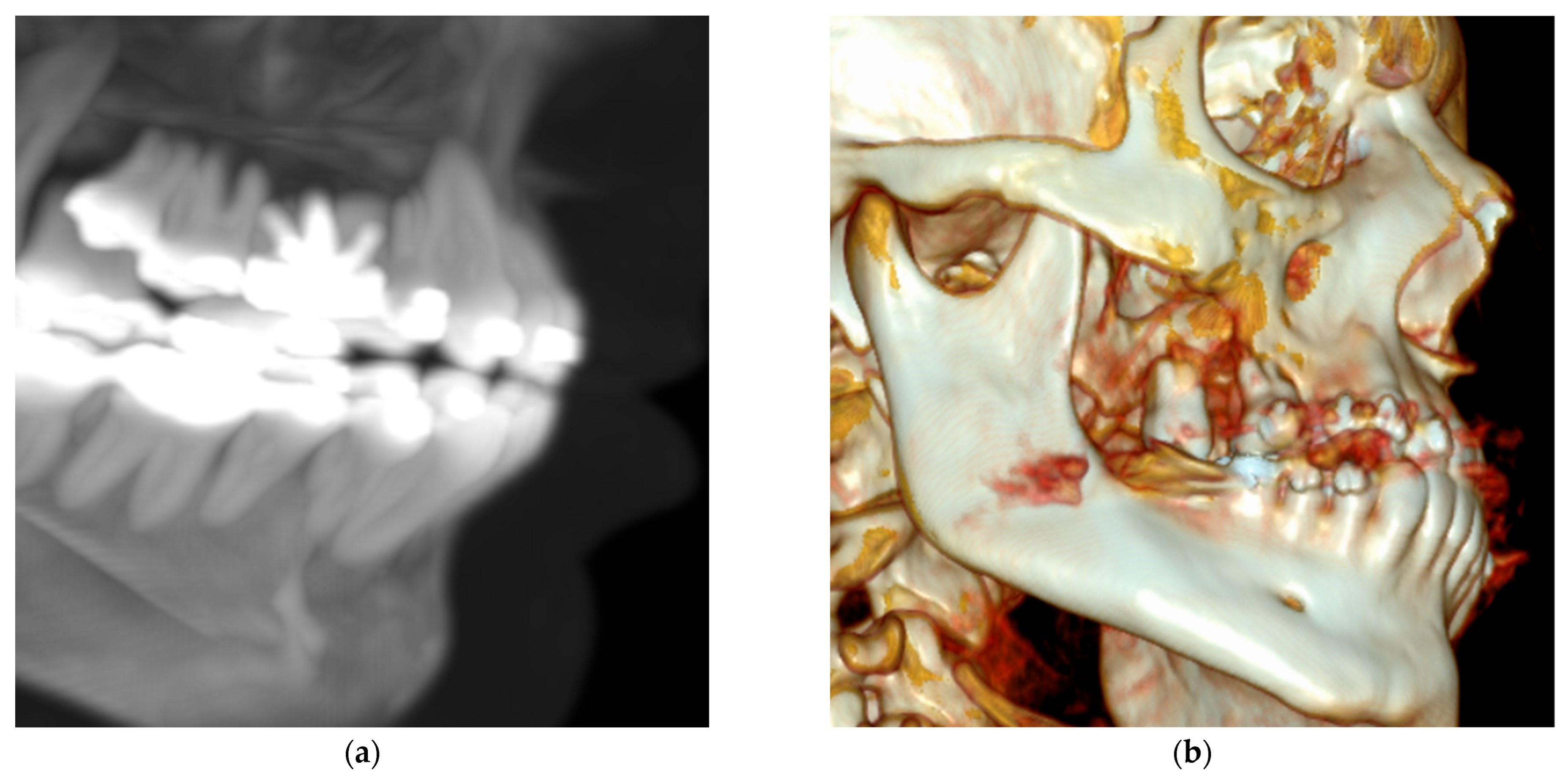 Dentistry 13 00491 g003
