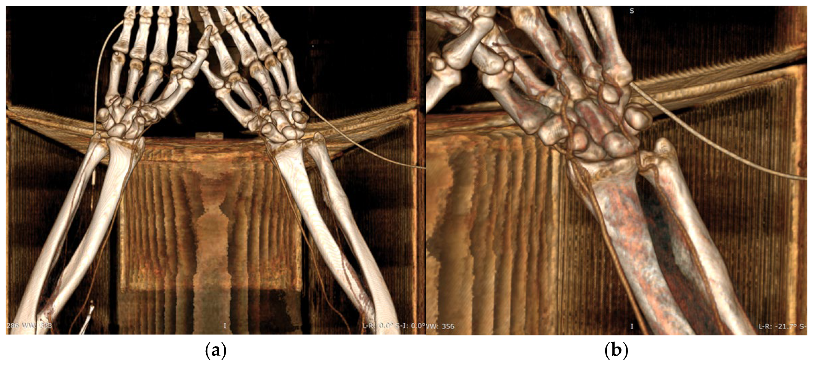 Dentistry 13 00499 g005