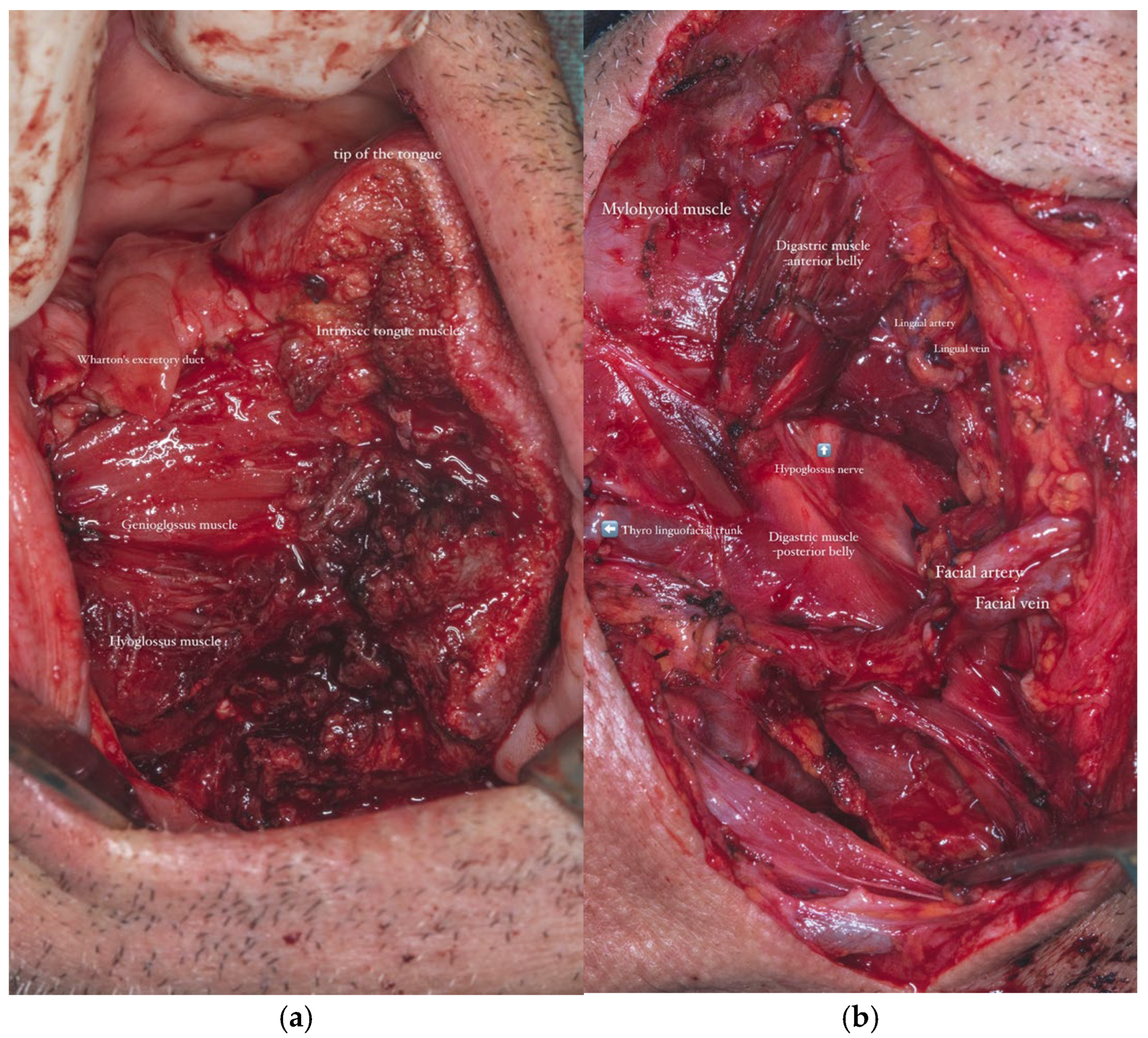 Dentistry 13 00499 g008
