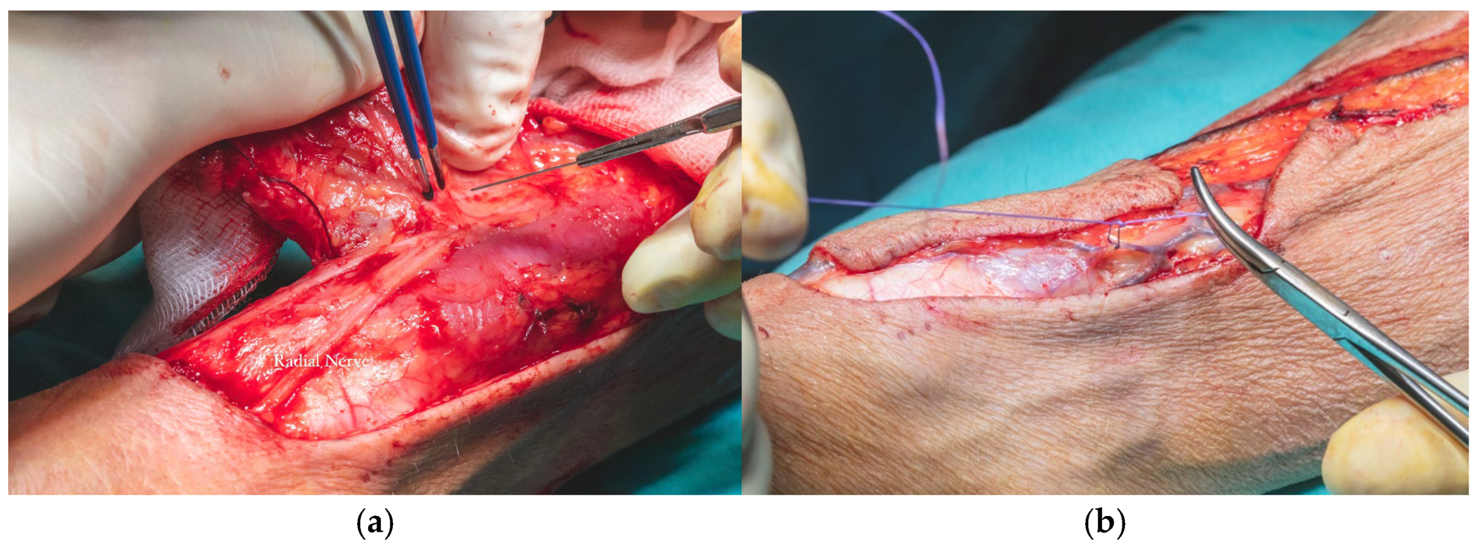 Dentistry 13 00499 g013