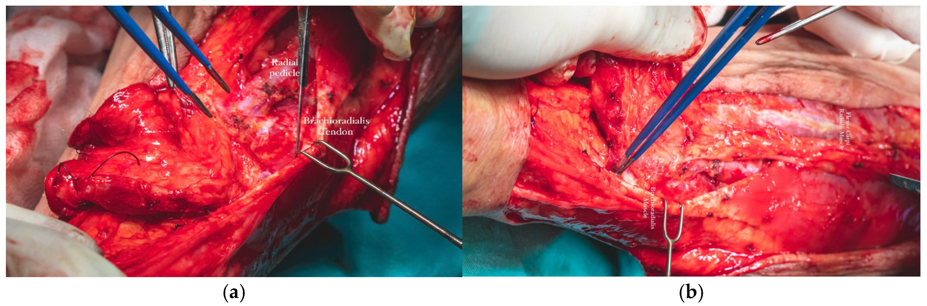 Dentistry 13 00499 g015