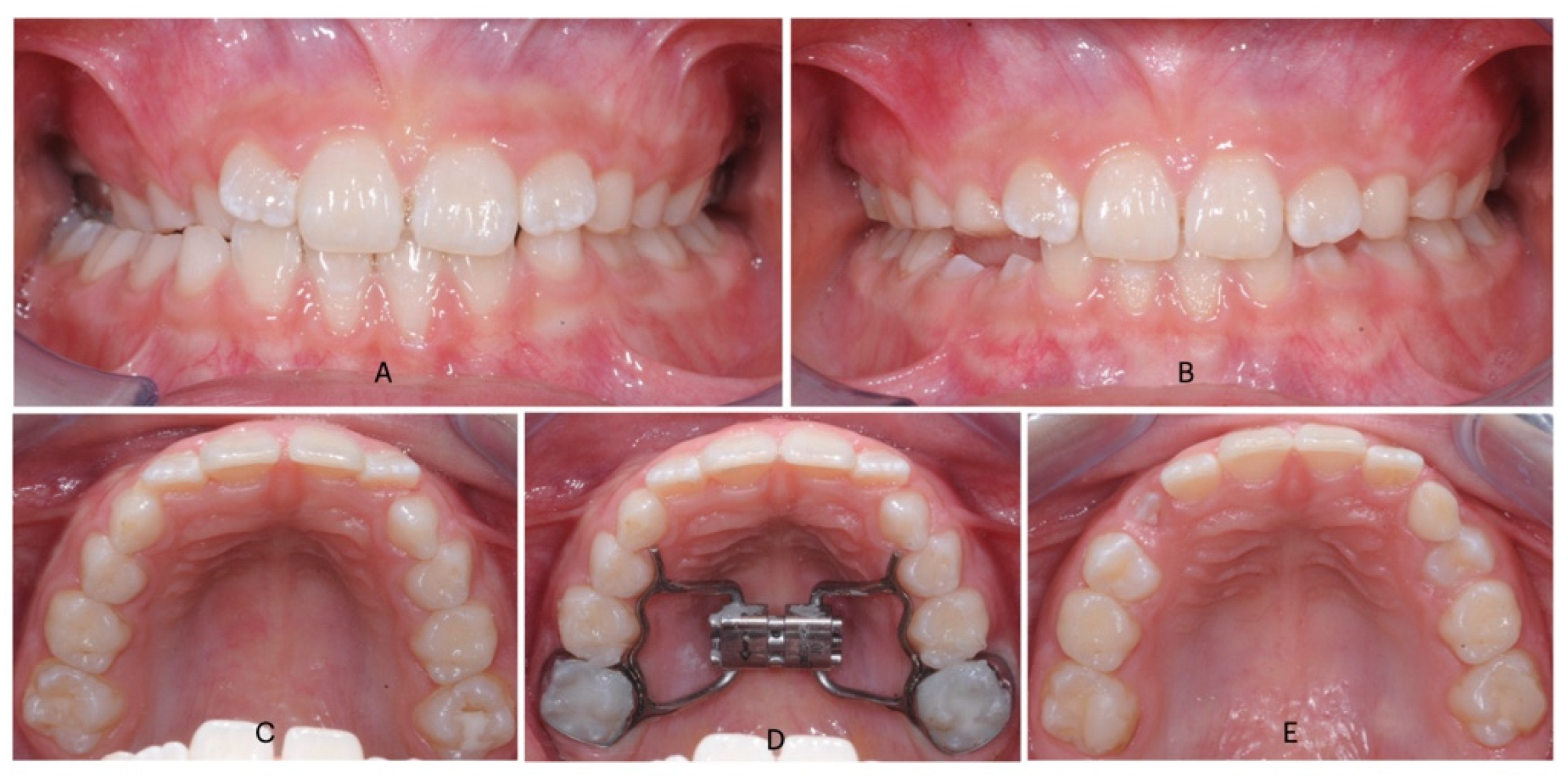 Dentistry 13 00504 g001 Dentistry 13 00504 g001