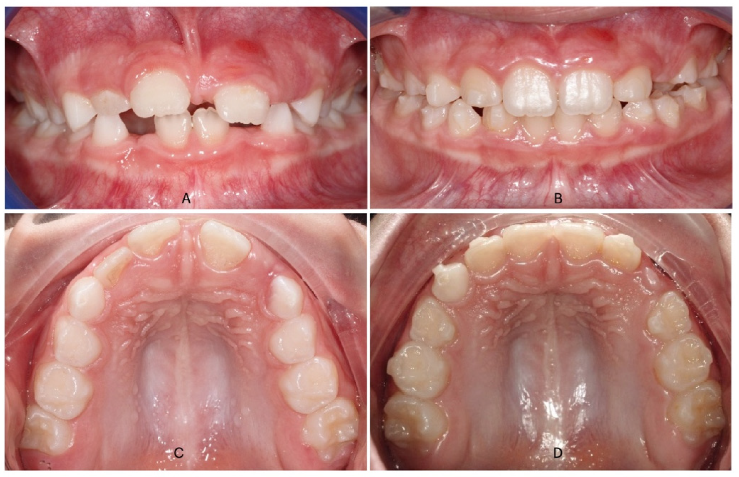 Dentistry 13 00504 g002 Dentistry 13 00504 g002