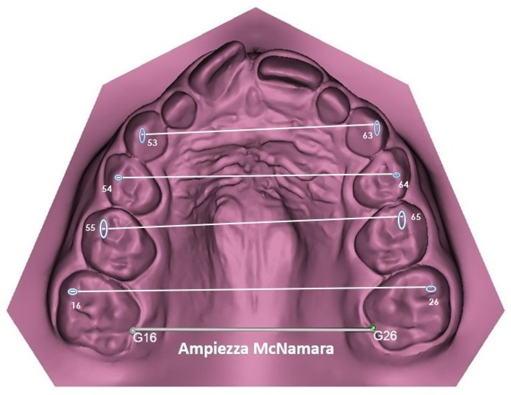 Dentistry 13 00504 g003 Dentistry 13 00504 g003