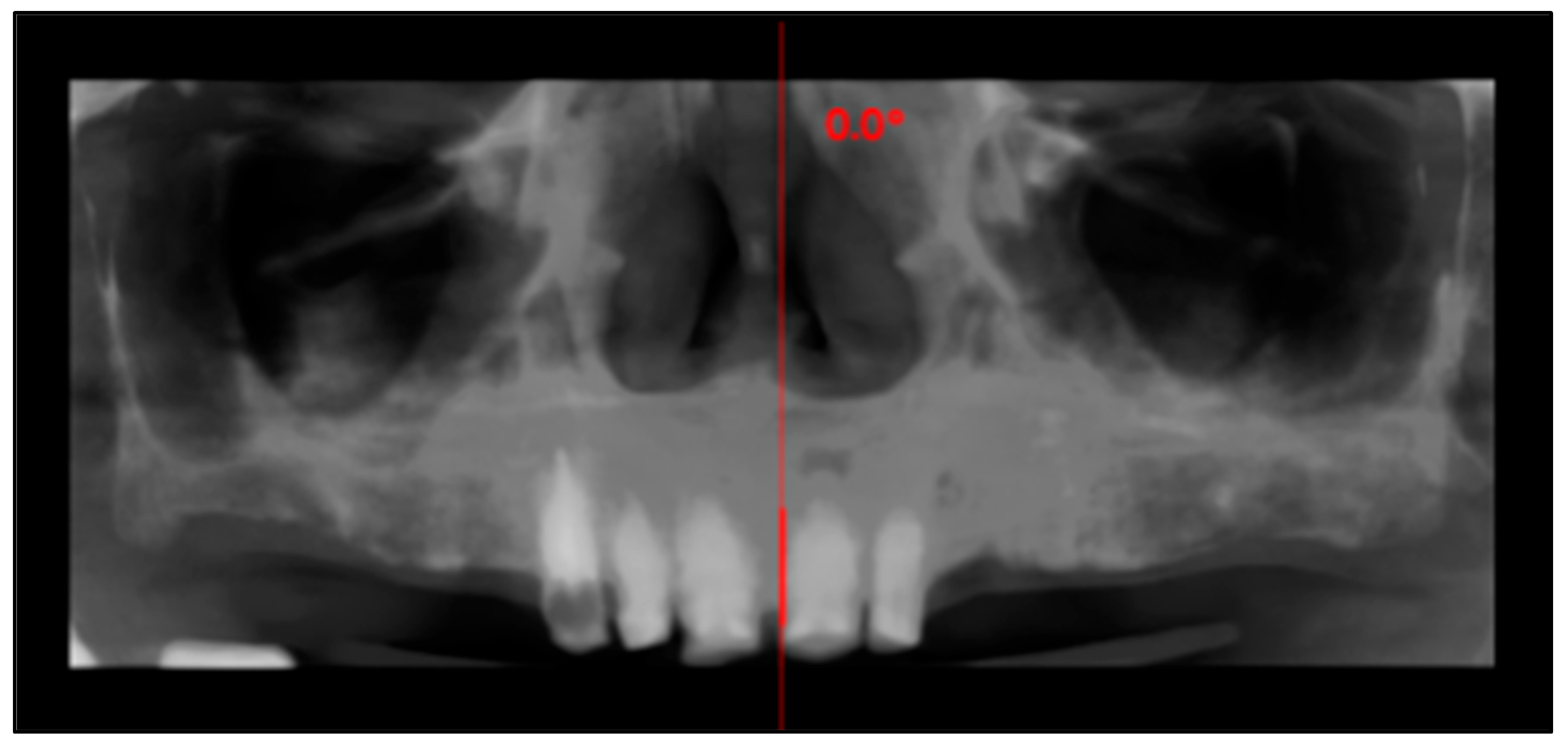 Dentistry 13 00516 g002 Dentistry 13 00516 g002