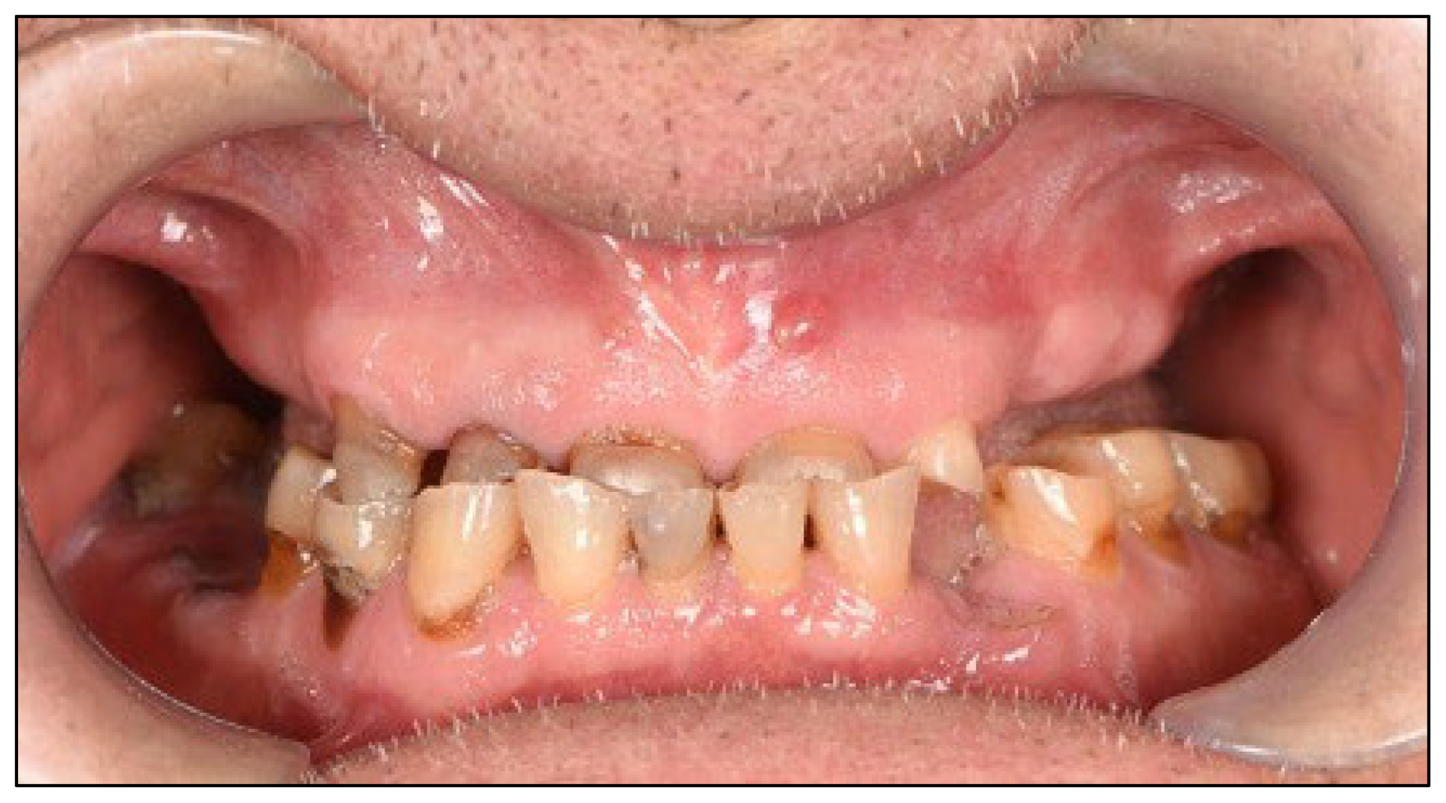 Dentistry 13 00516 g003 Dentistry 13 00516 g003