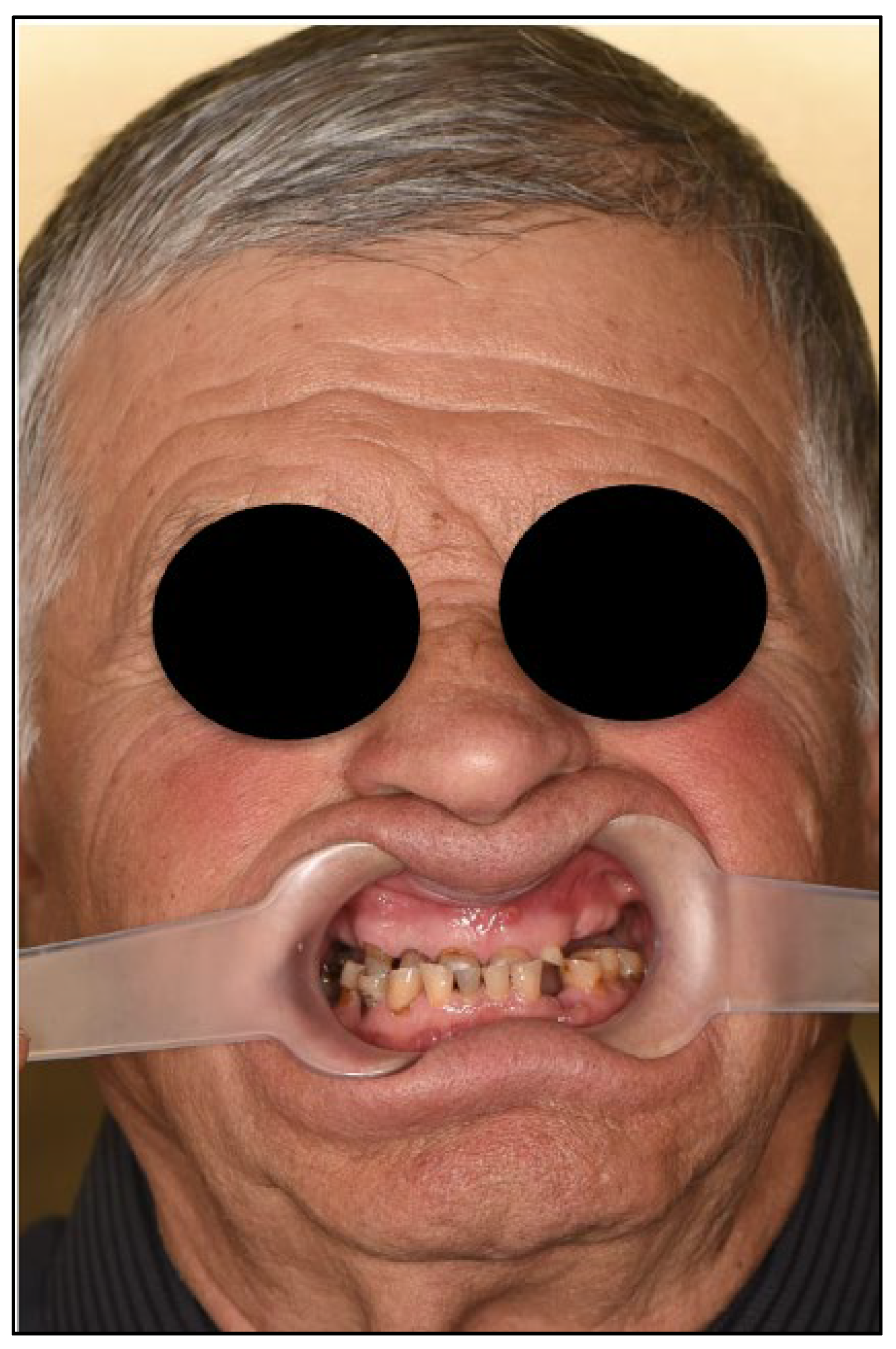 Dentistry 13 00516 g004 Dentistry 13 00516 g004