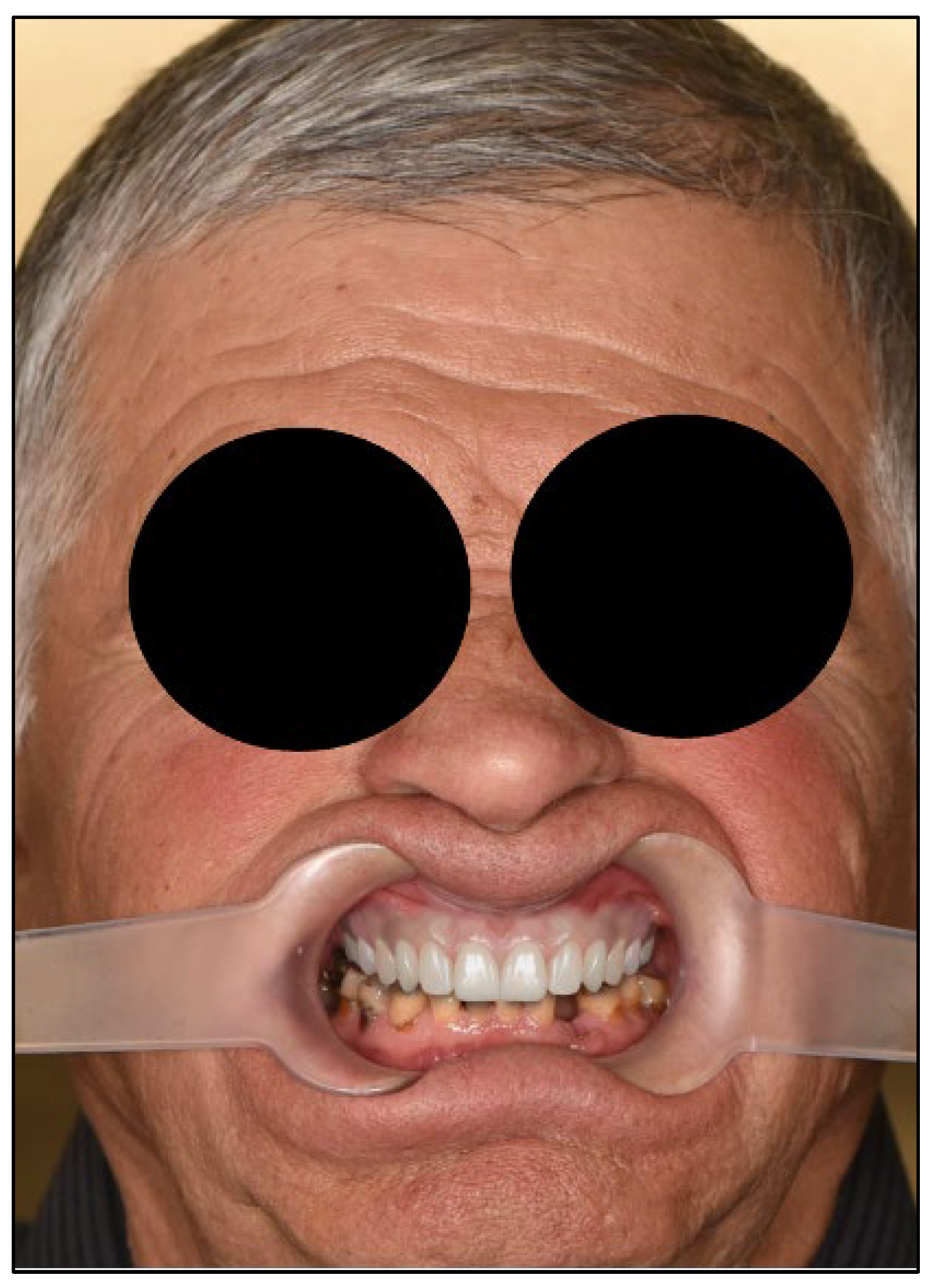 Dentistry 13 00516 g005 Dentistry 13 00516 g005