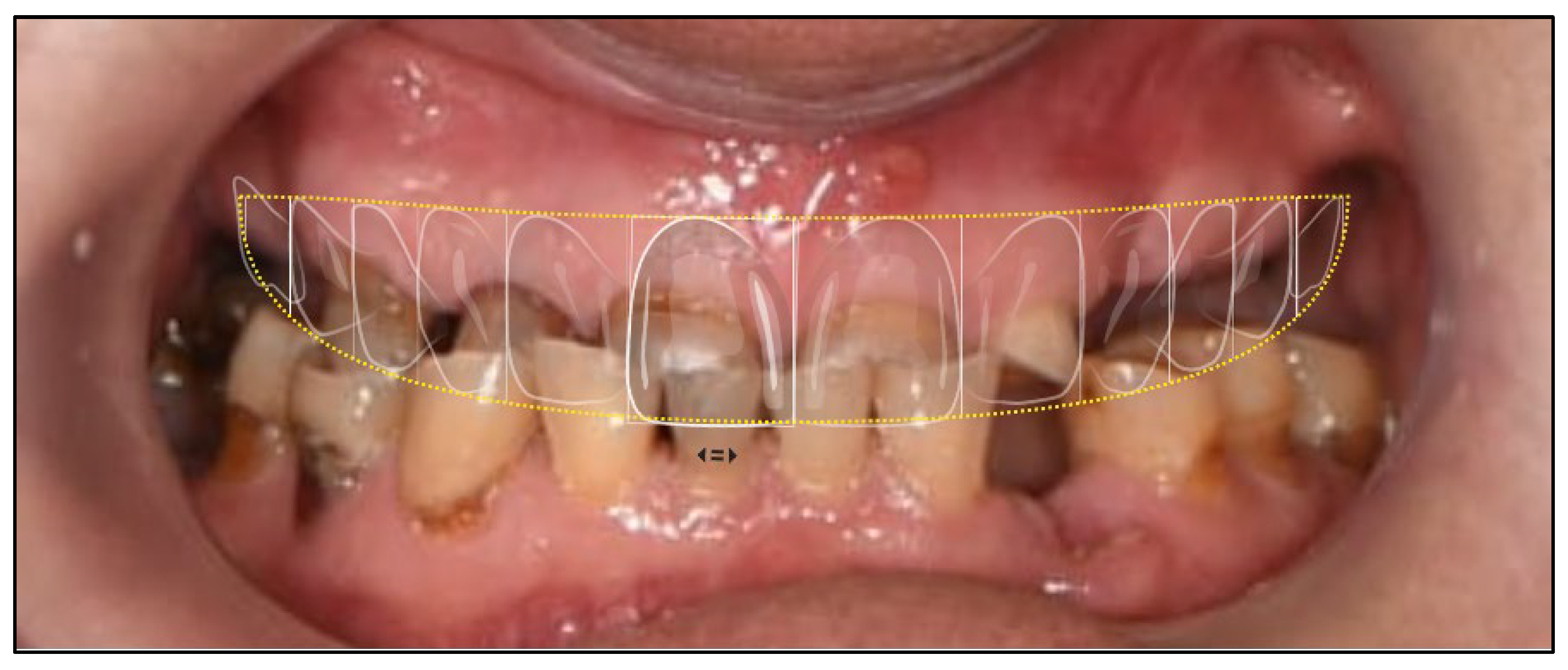 Dentistry 13 00516 g006 Dentistry 13 00516 g006