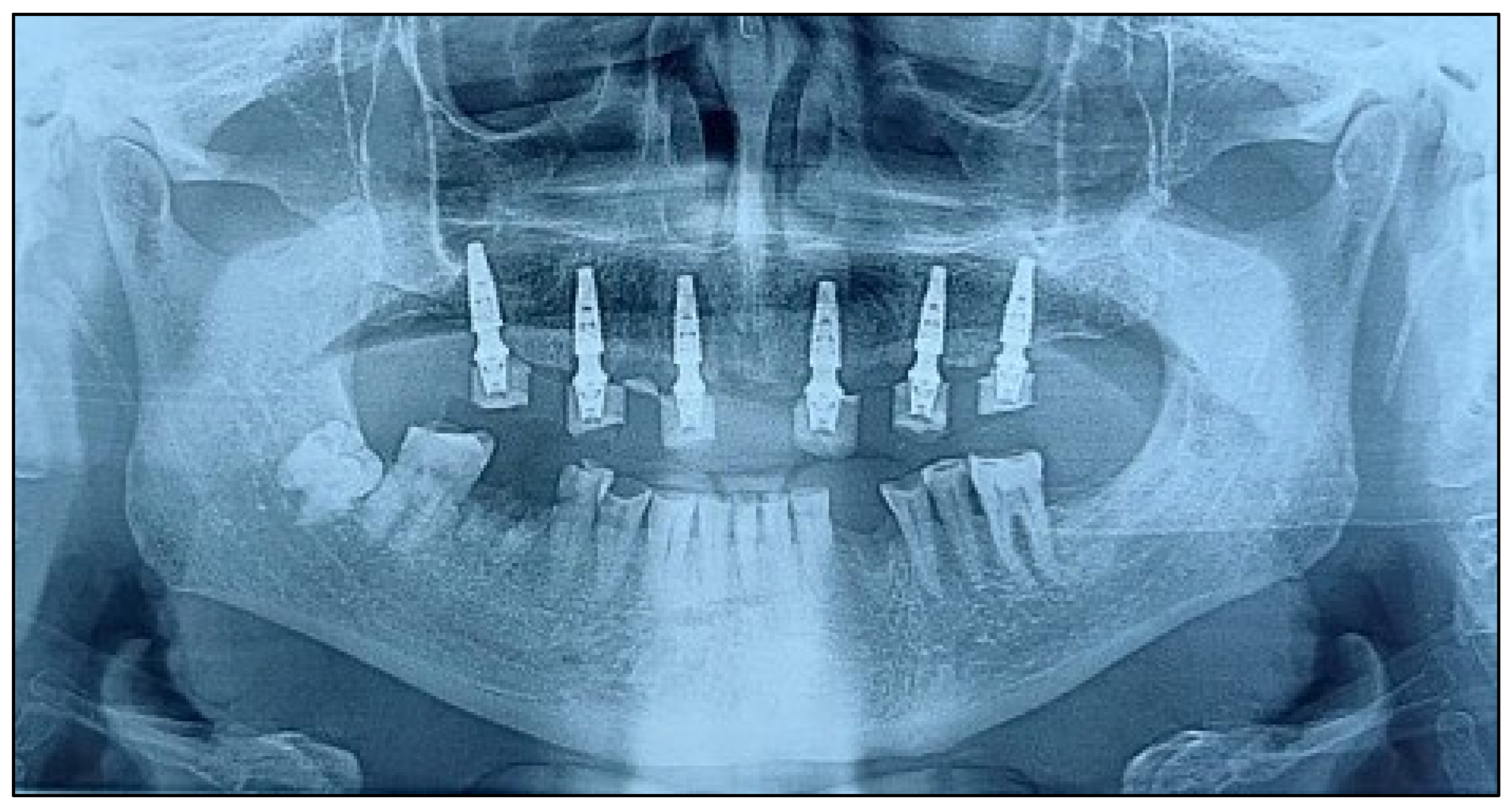 Dentistry 13 00516 g010 Dentistry 13 00516 g010