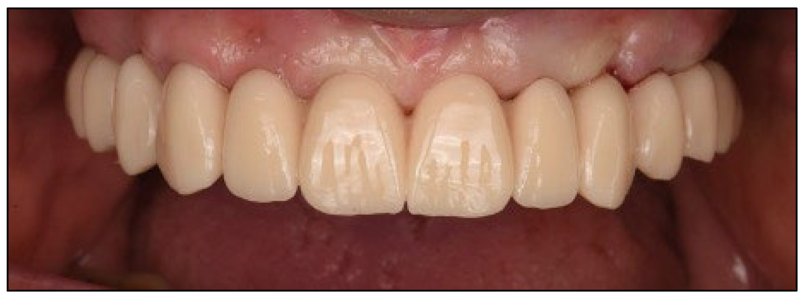 Dentistry 13 00516 g011 Dentistry 13 00516 g011