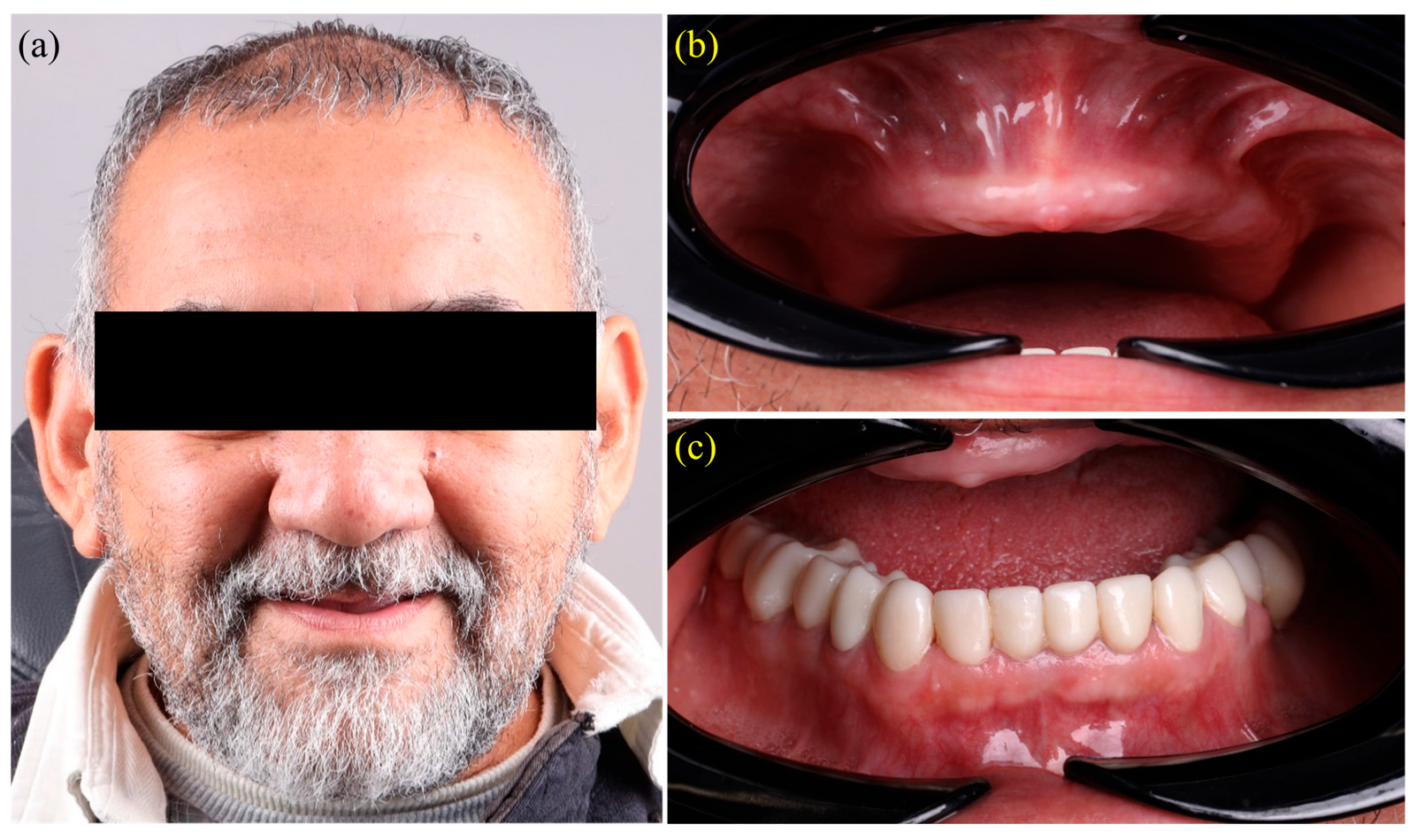Dentistry 13 00524 g001 Dentistry 13 00524 g001