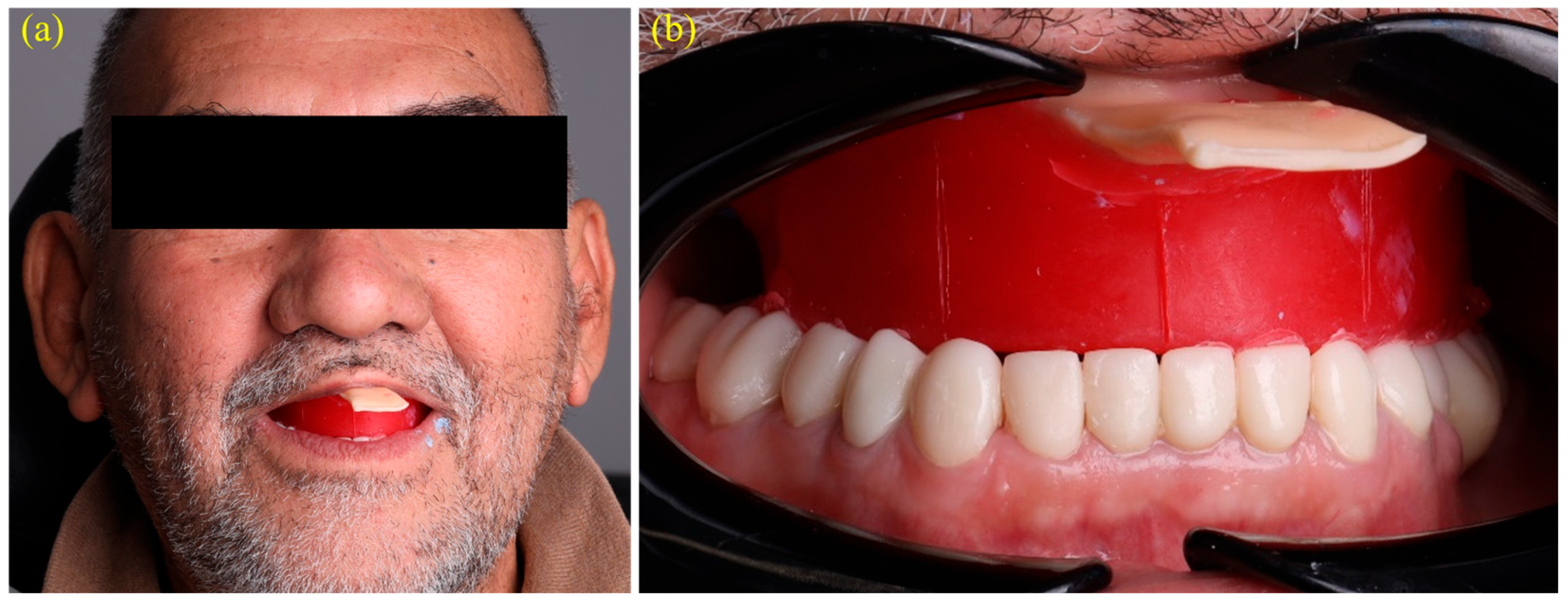 Dentistry 13 00524 g004 Dentistry 13 00524 g004