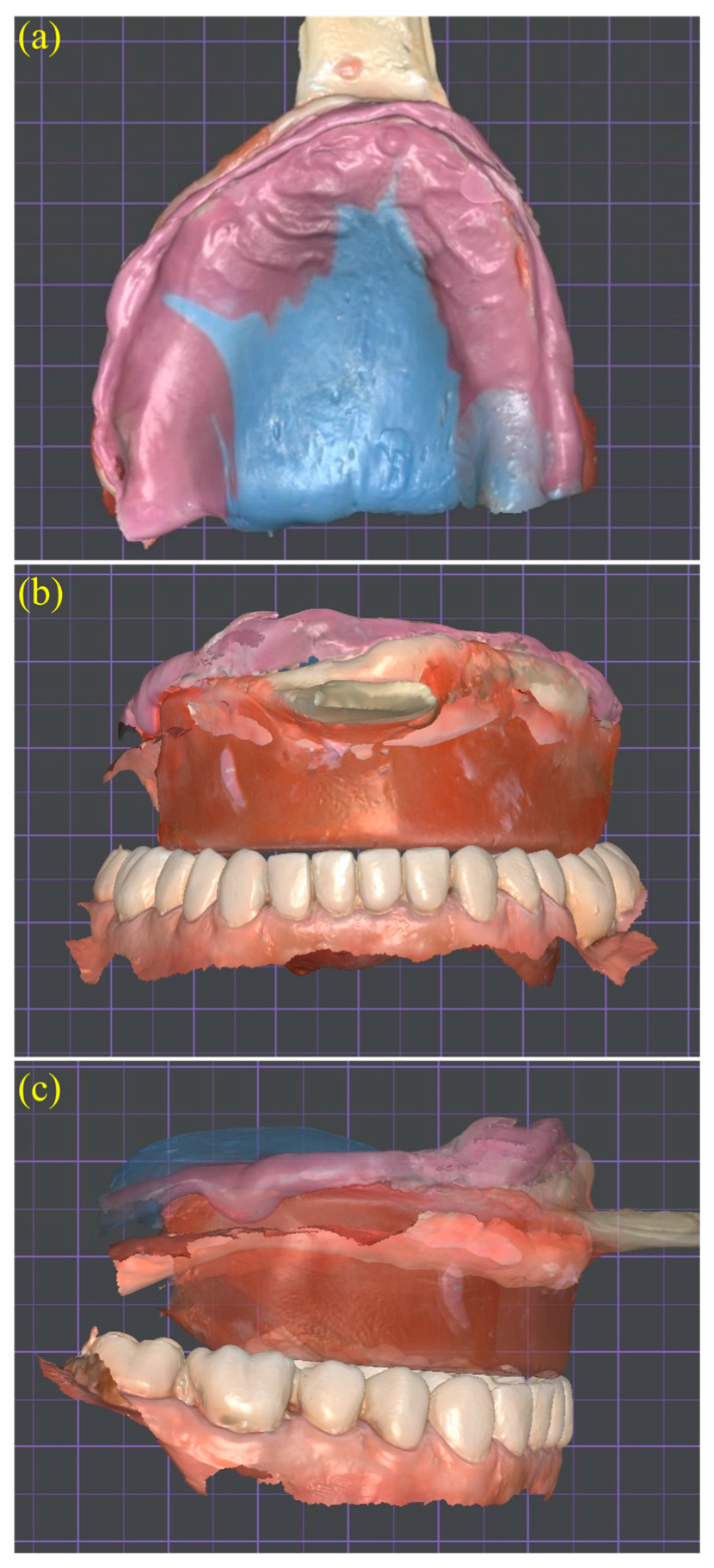 Dentistry 13 00524 g005 Dentistry 13 00524 g005
