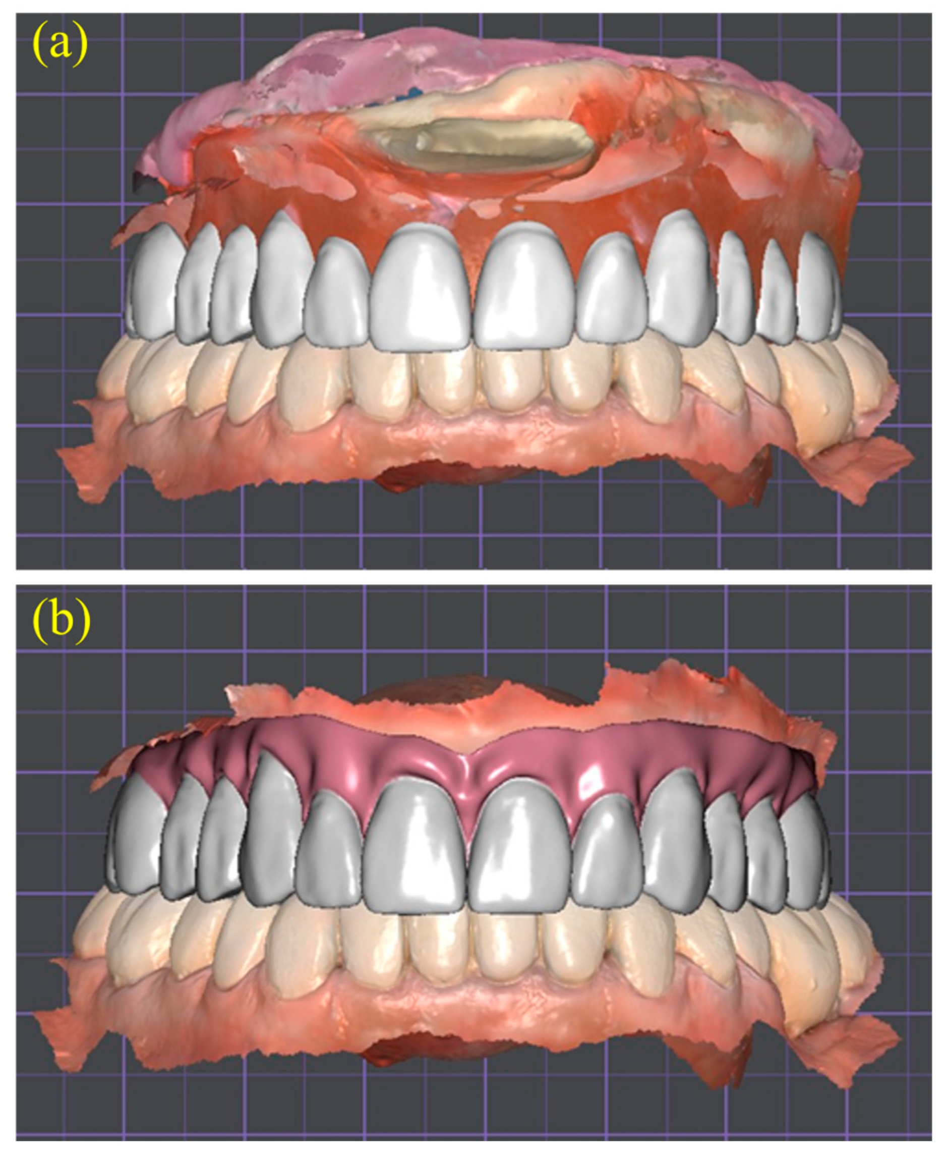 Dentistry 13 00524 g006 Dentistry 13 00524 g006