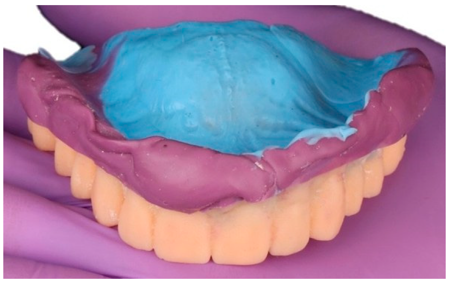 Dentistry 13 00524 g007 Dentistry 13 00524 g007