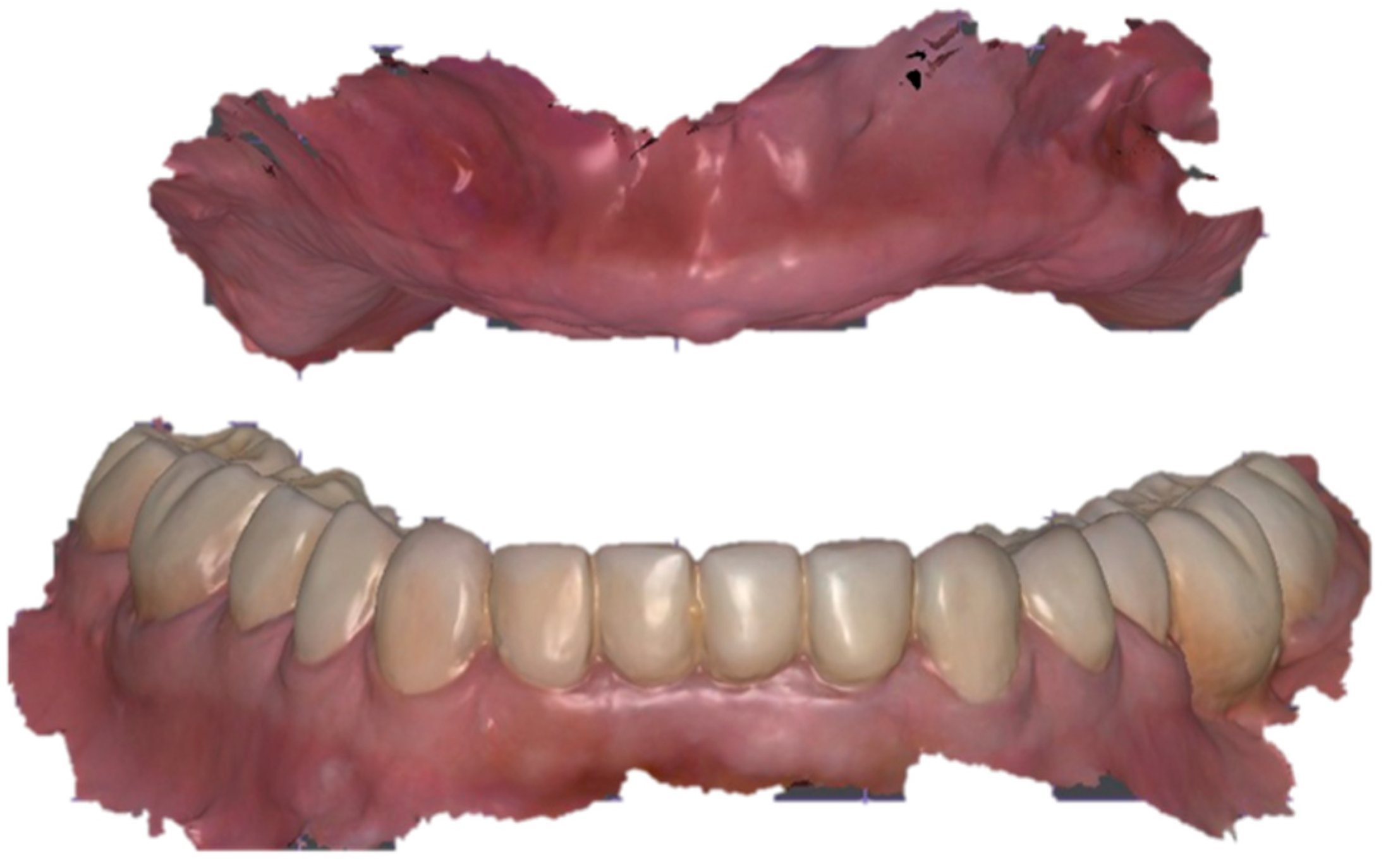 Dentistry 13 00524 g009 Dentistry 13 00524 g009
