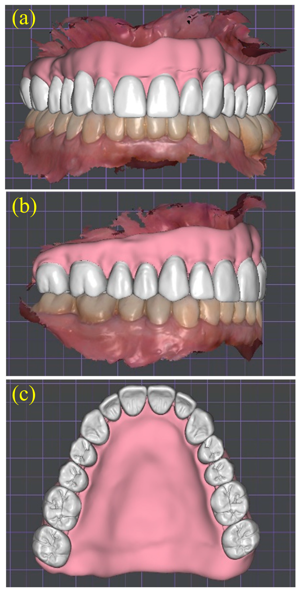 Dentistry 13 00524 g010 Dentistry 13 00524 g010