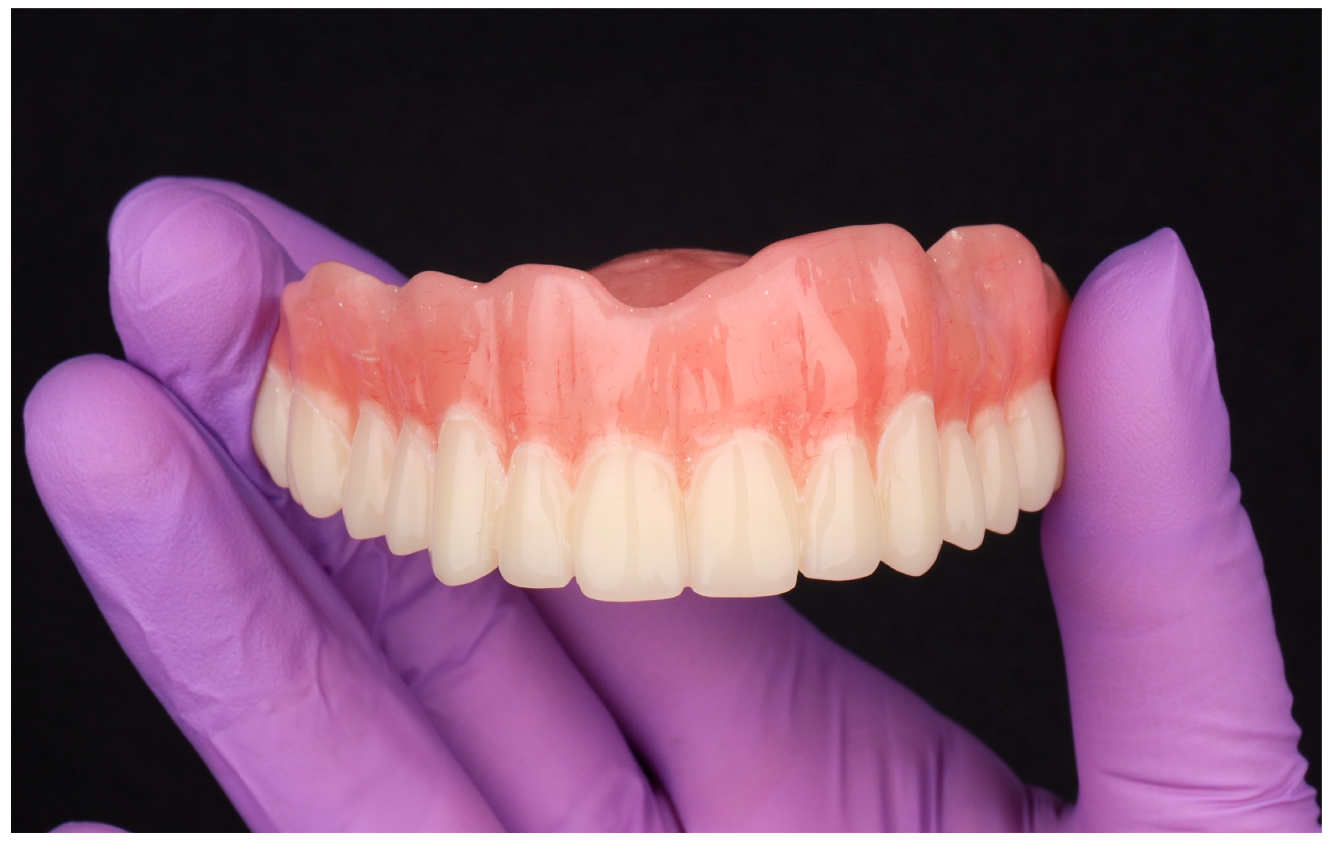 Dentistry 13 00524 g011 Dentistry 13 00524 g011