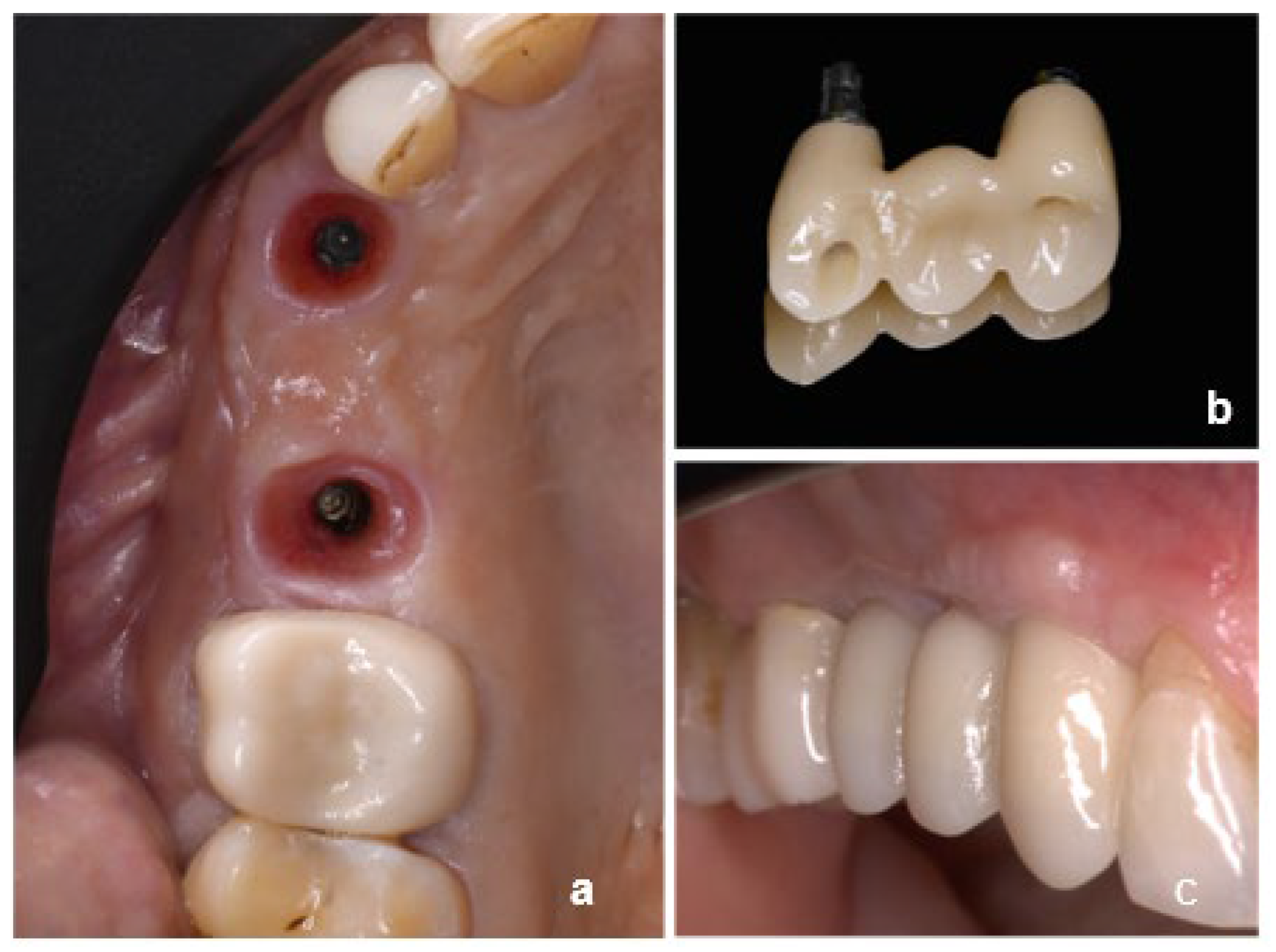 Dentistry 13 00525 g001 Dentistry 13 00525 g001