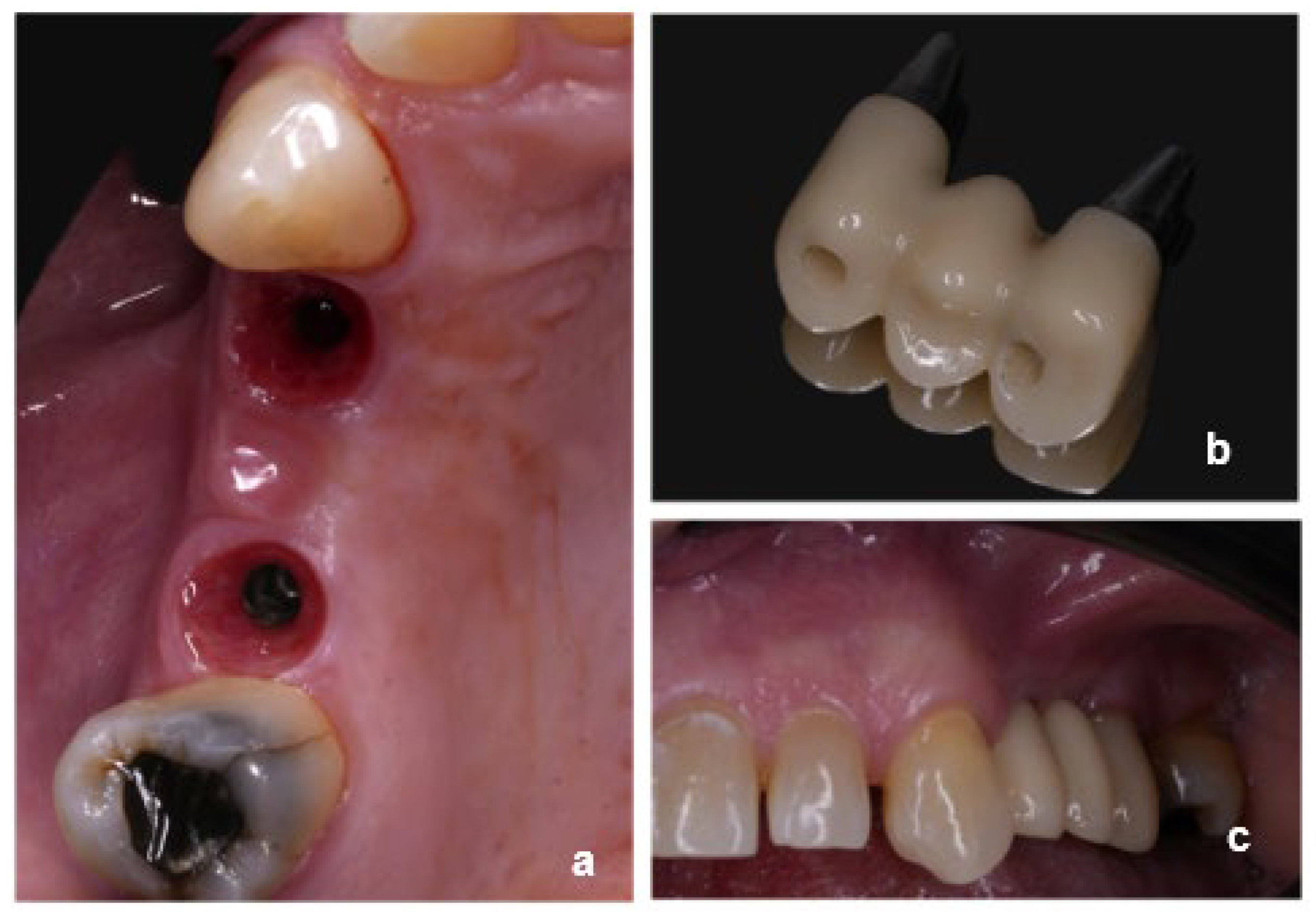 Dentistry 13 00525 g002 Dentistry 13 00525 g002
