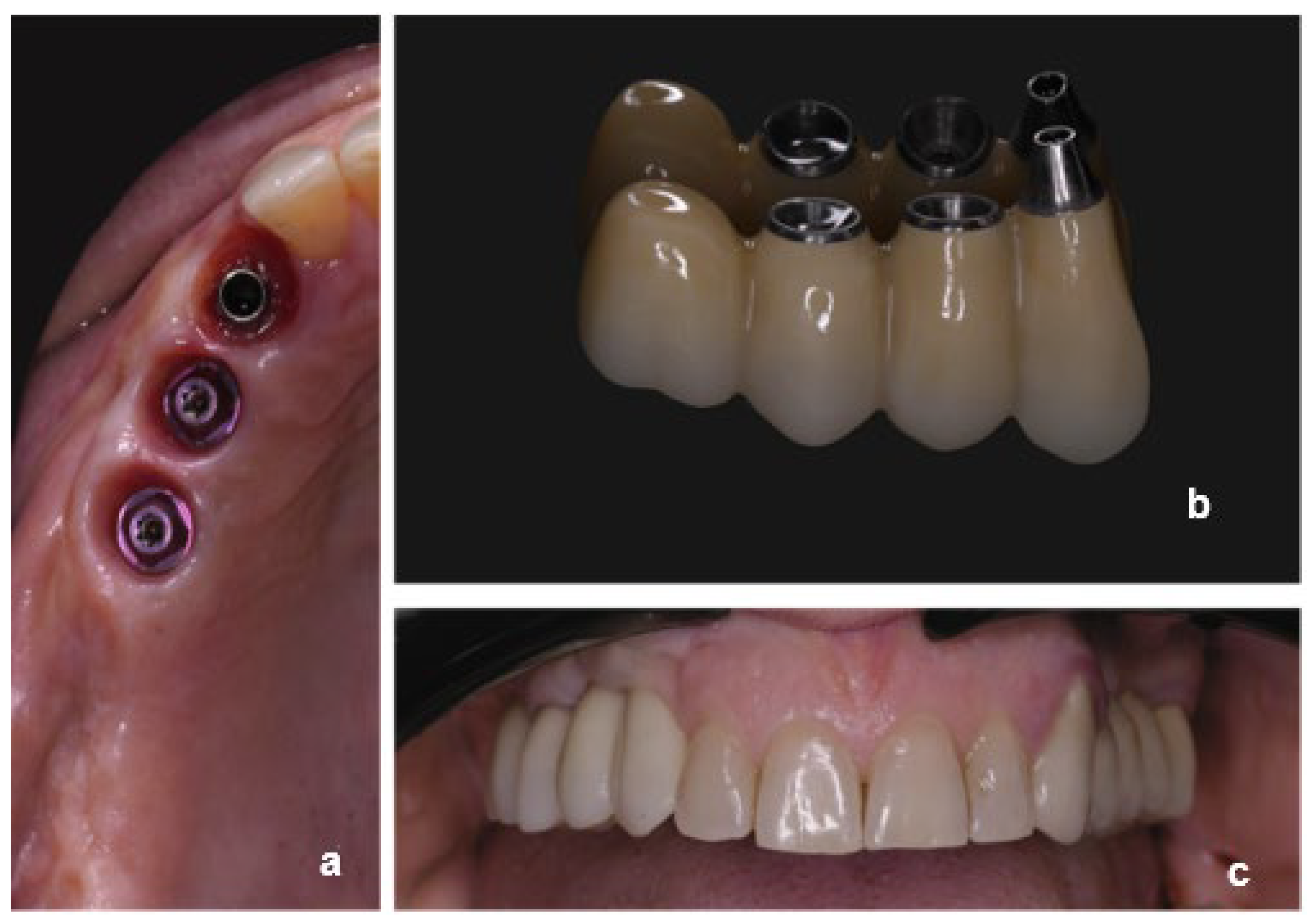 Dentistry 13 00525 g003 Dentistry 13 00525 g003