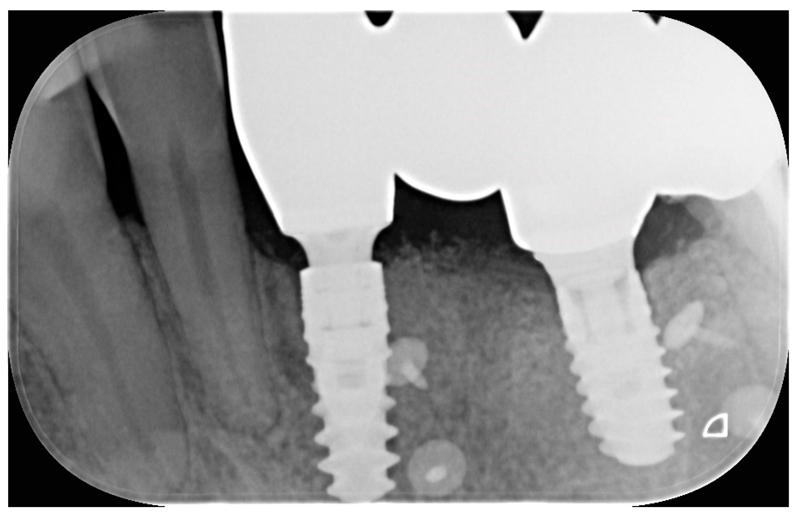 Dentistry 13 00525 g005 Dentistry 13 00525 g005