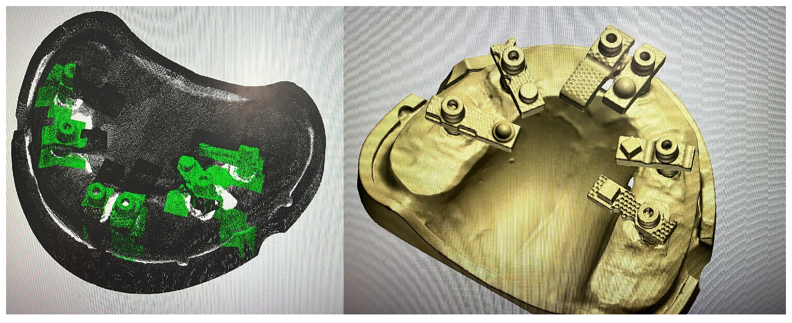 Dentistry 13 00533 g003 Dentistry 13 00533 g003