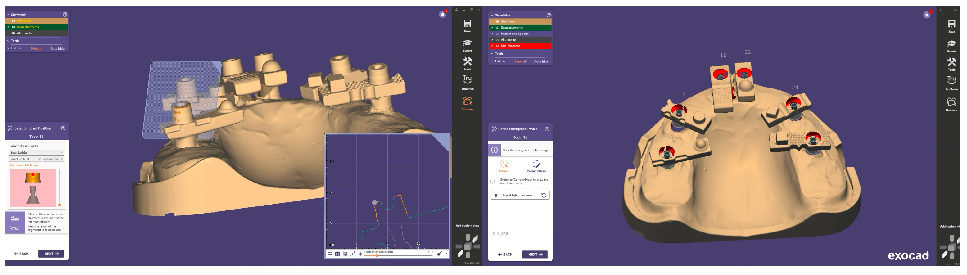 Dentistry 13 00533 g005 Dentistry 13 00533 g005