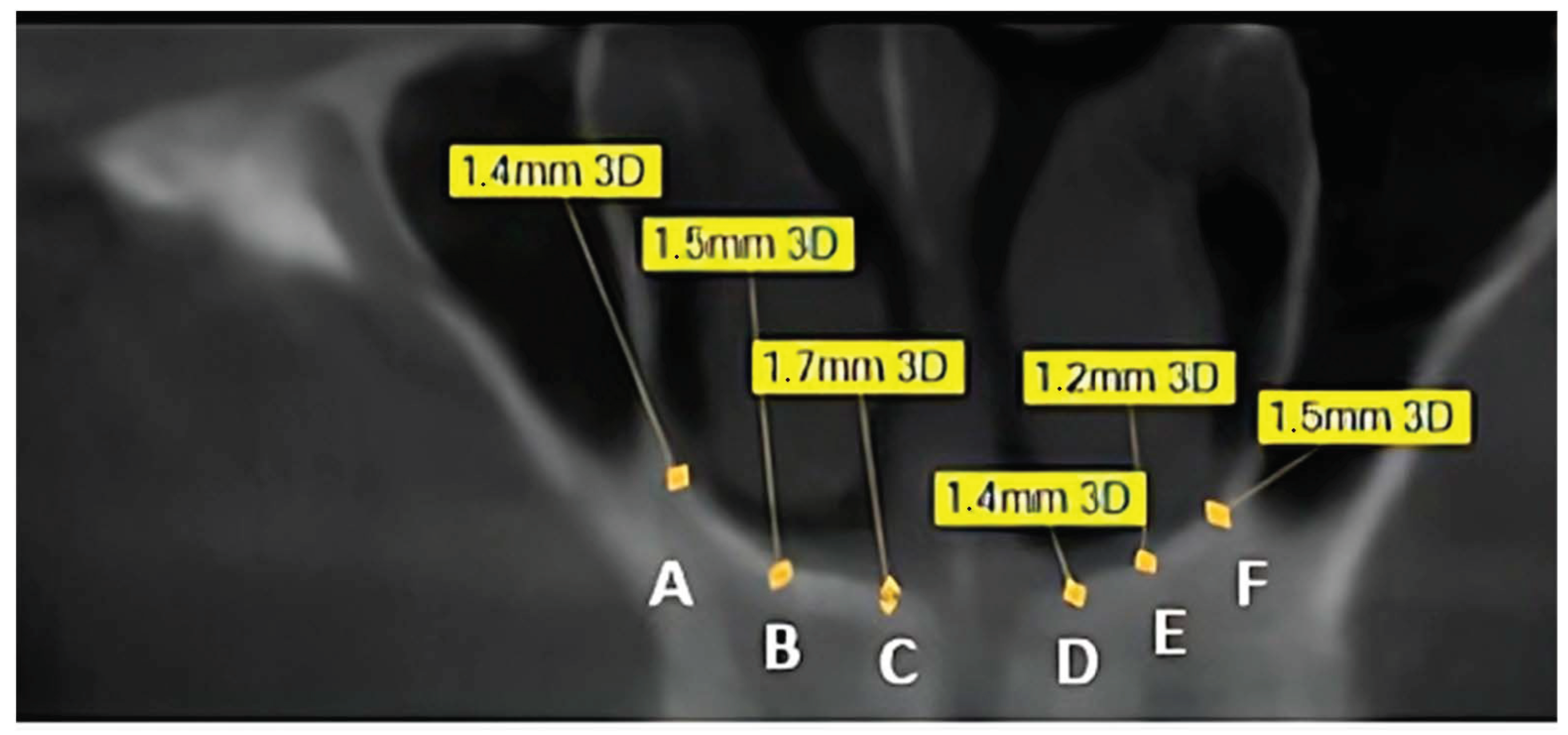 Dentistry 13 00539 g001 Dentistry 13 00539 g001