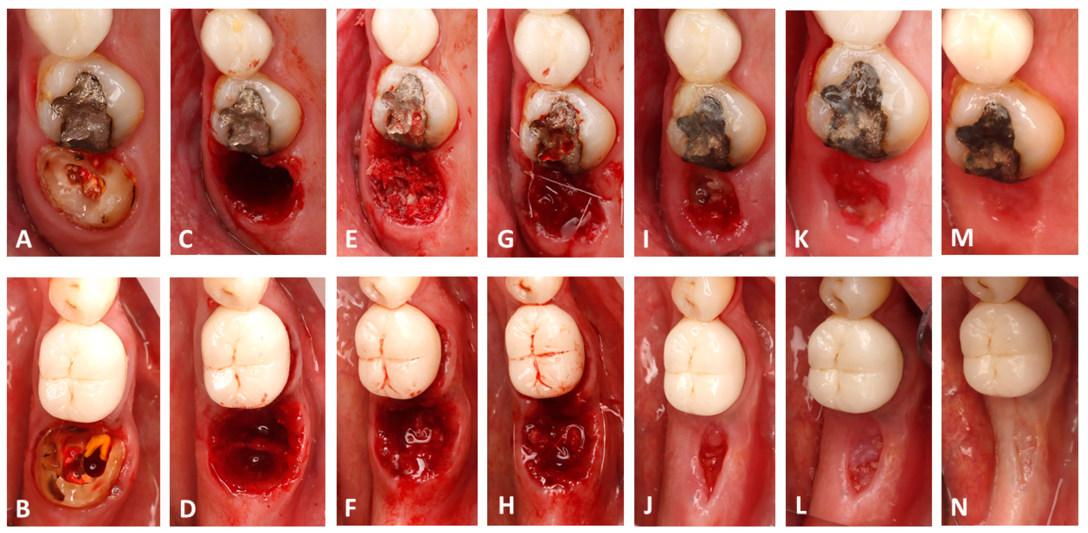 Dentistry 13 00545 g001 Dentistry 13 00545 g001