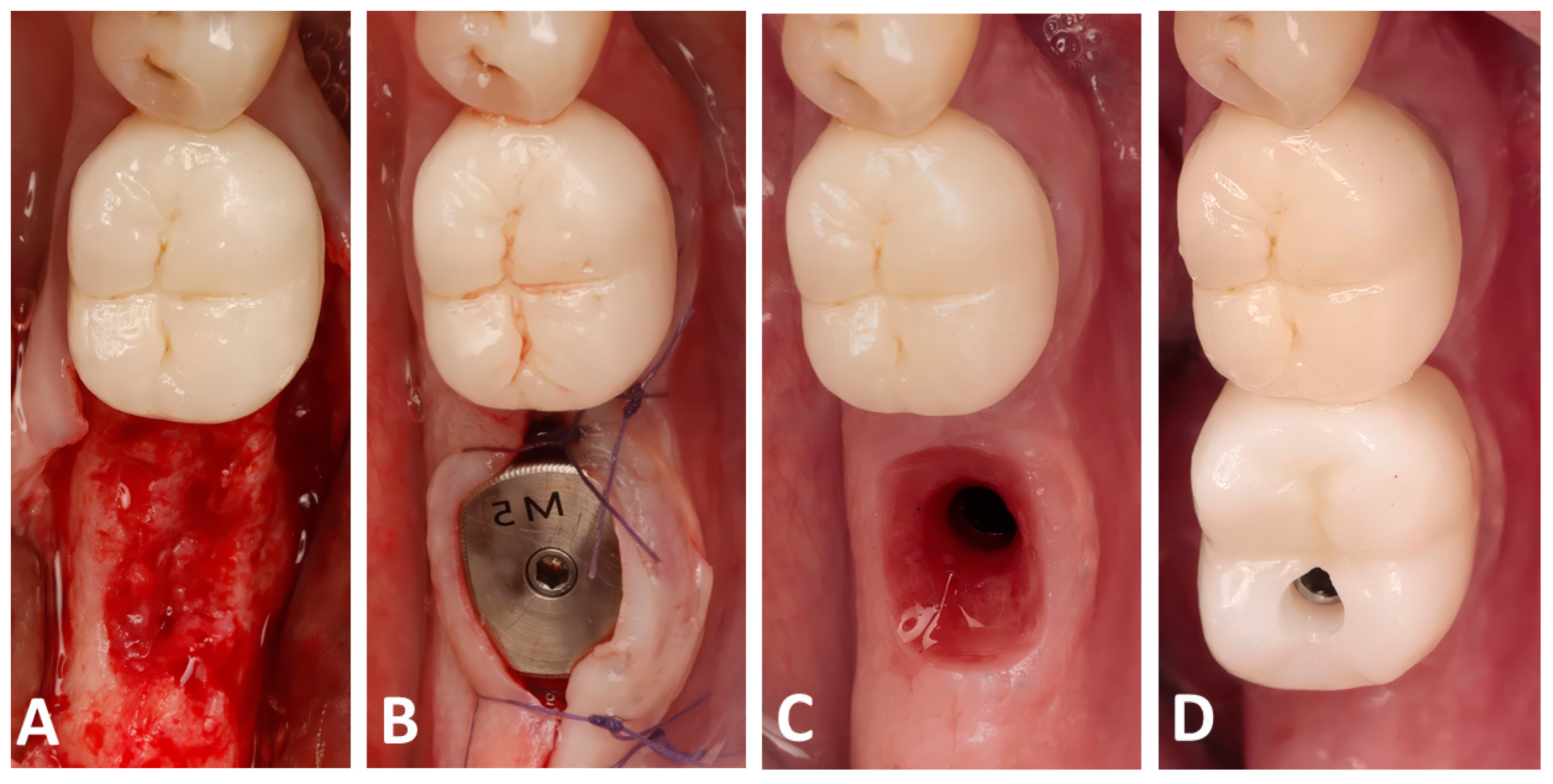 Dentistry 13 00545 g003 Dentistry 13 00545 g003
