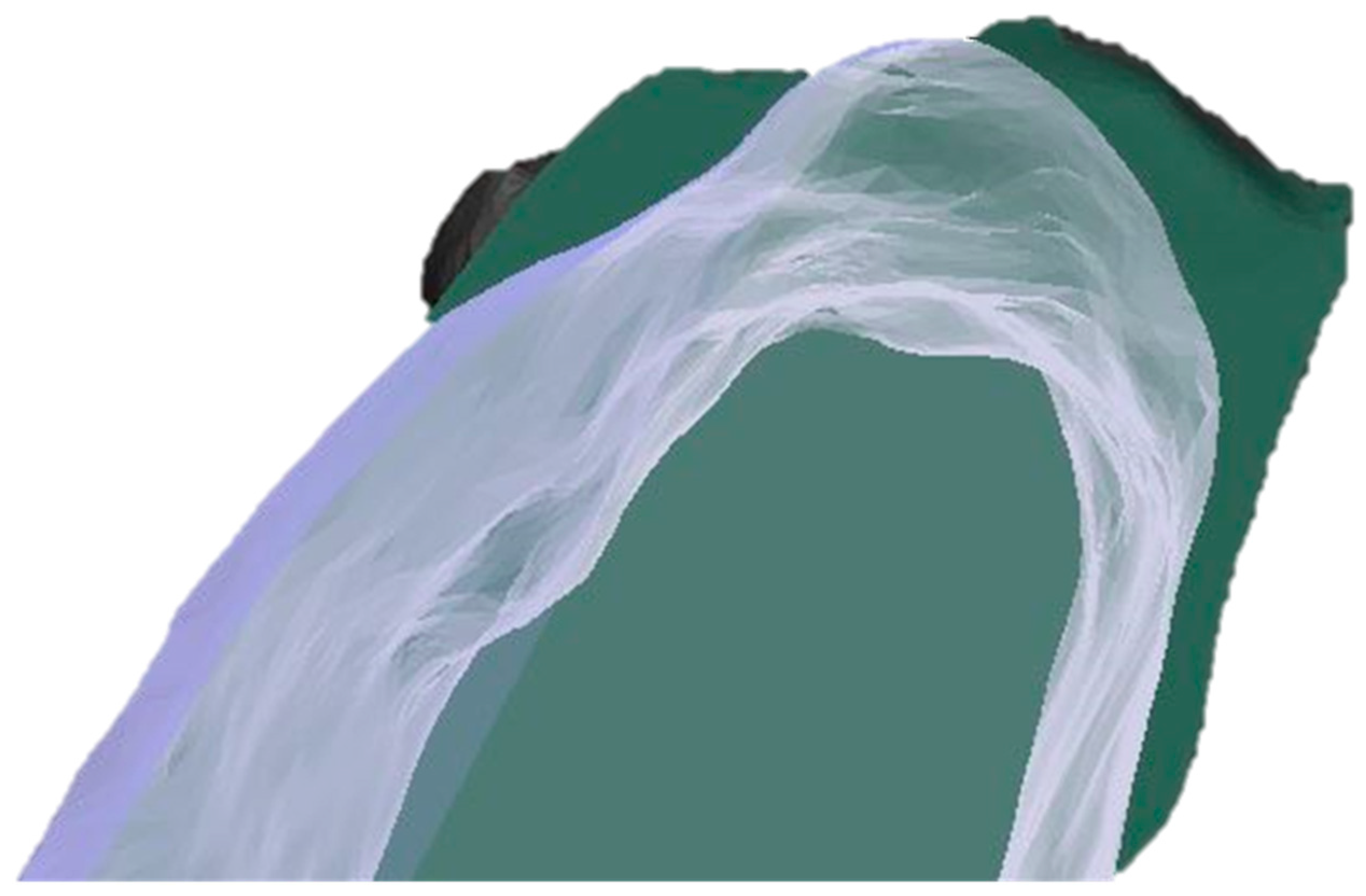 Dentistry 13 00545 g005 Dentistry 13 00545 g005