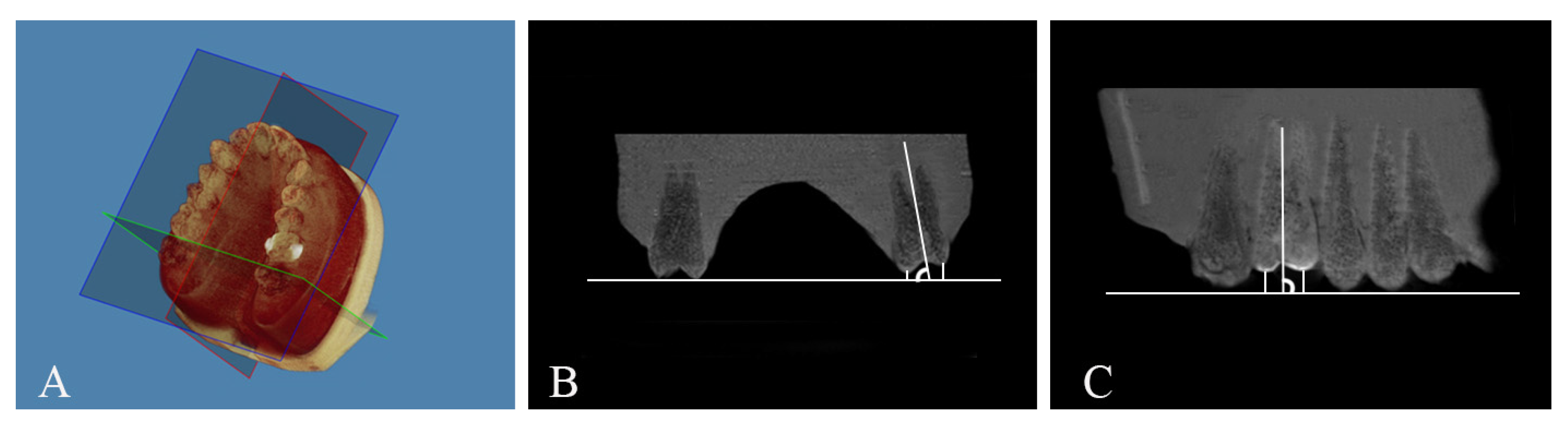 Dentistry 13 00551 g004