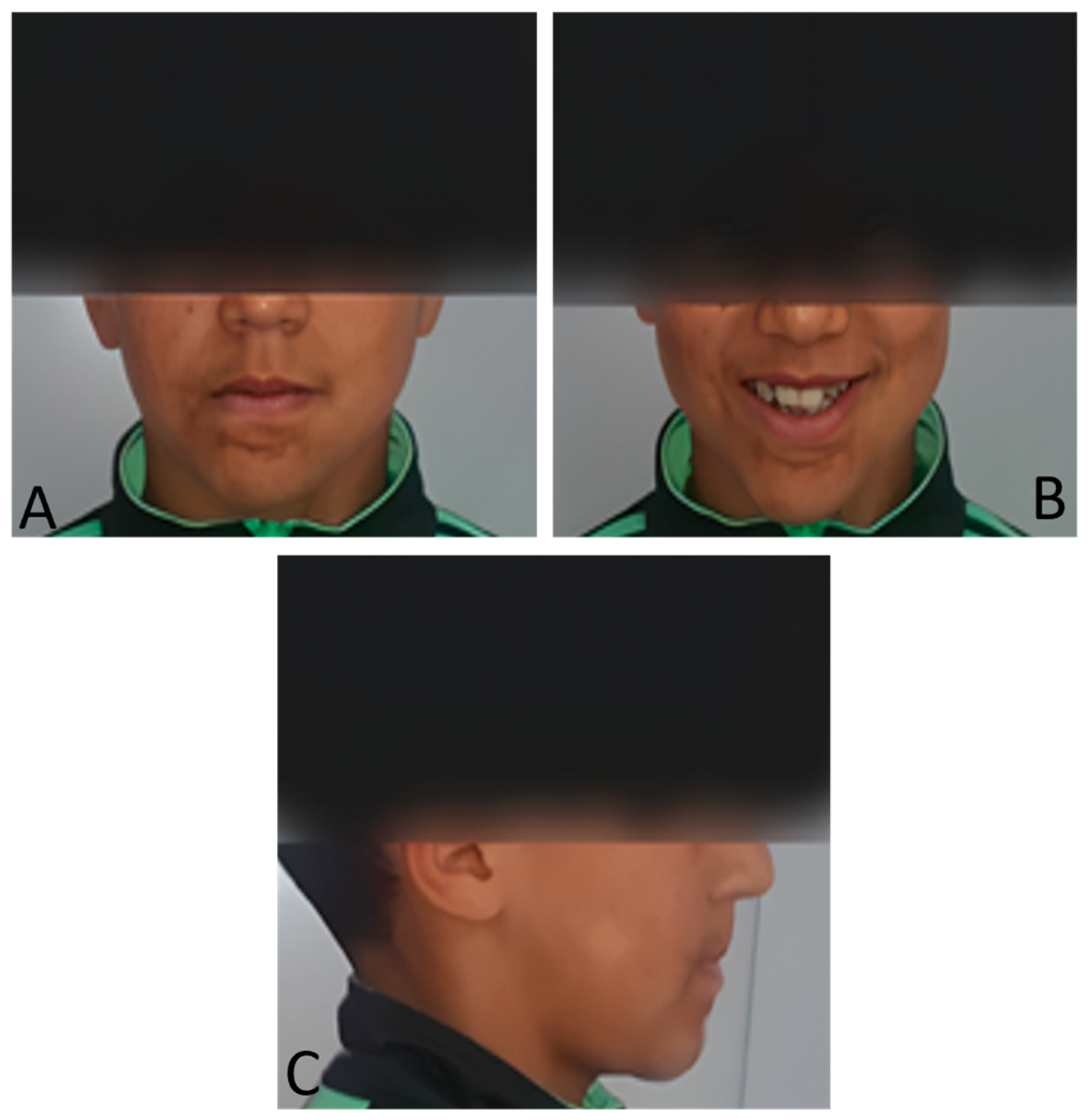 Dentistry 13 00559 g001 Dentistry 13 00559 g001