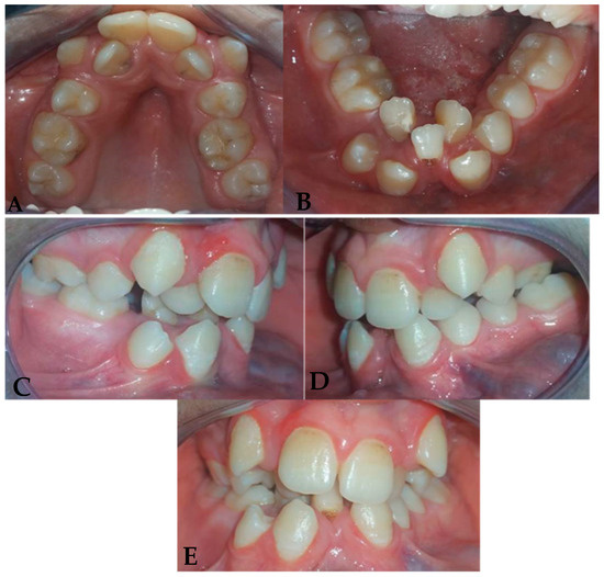 Dentistry 13 00559 g002