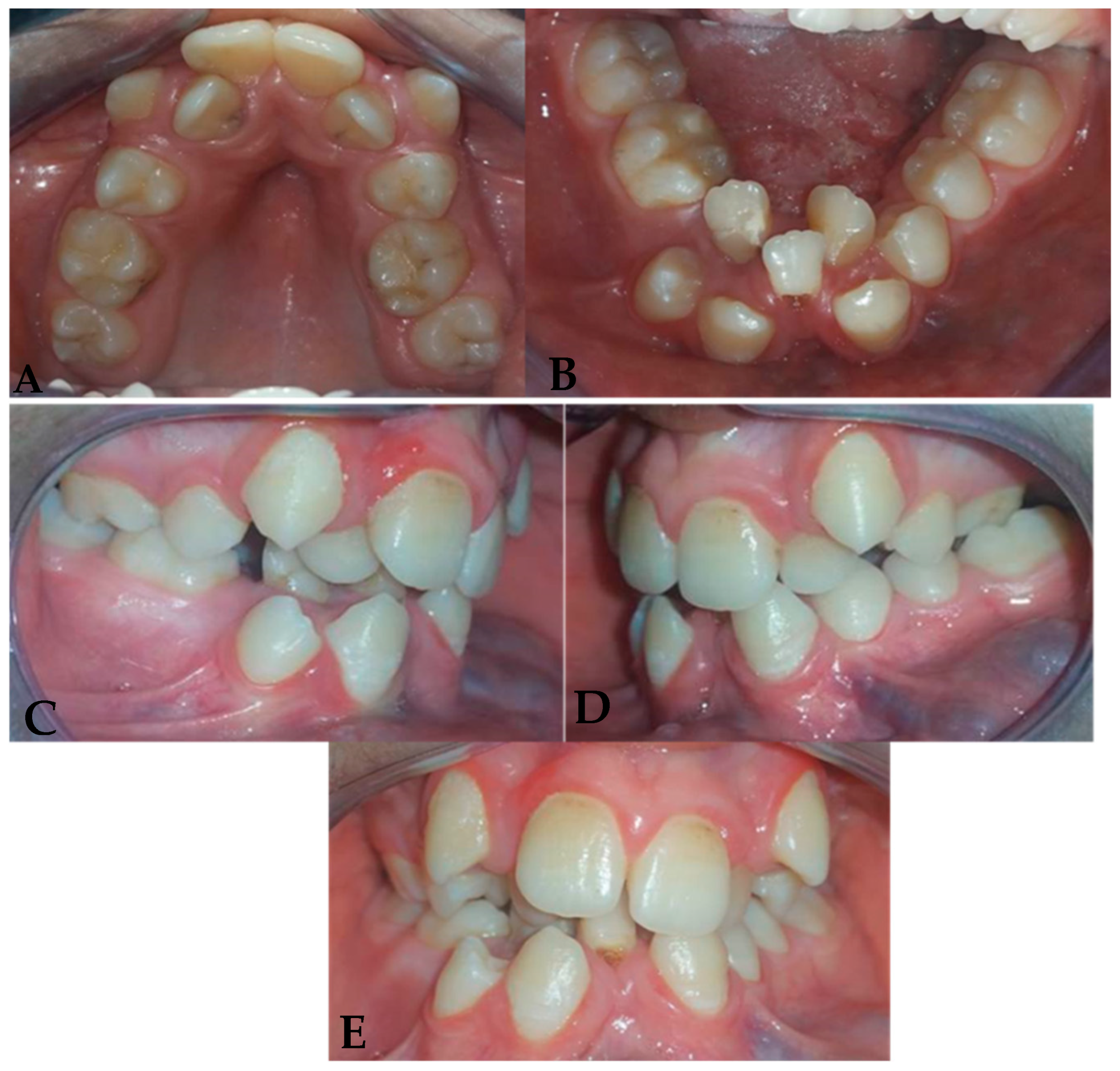Dentistry 13 00559 g002 Dentistry 13 00559 g002