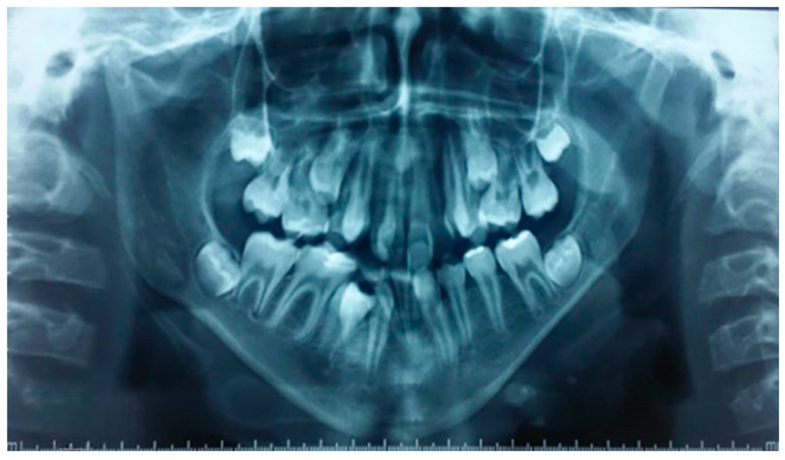 Dentistry 13 00559 g003 Dentistry 13 00559 g003