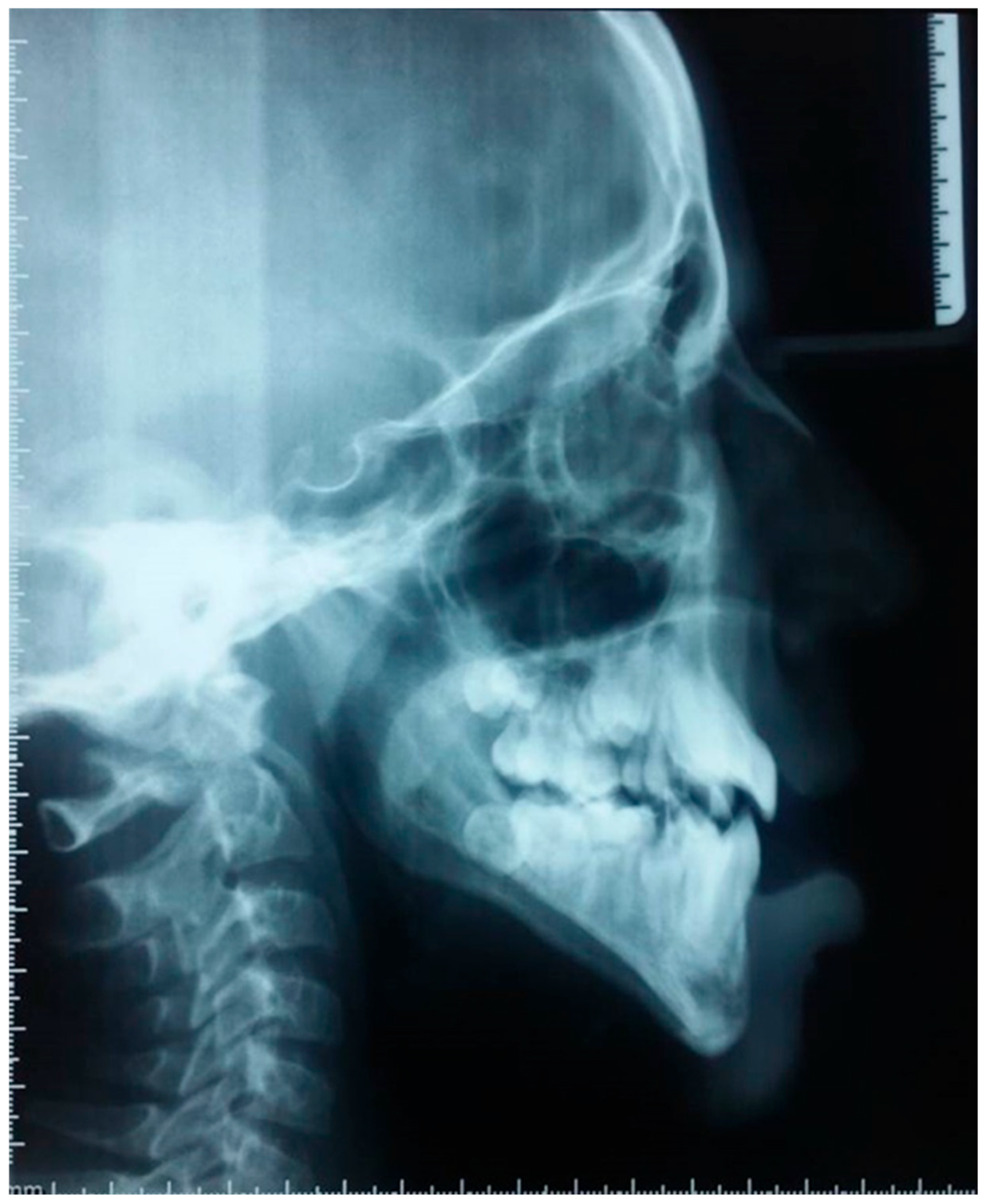 Dentistry 13 00559 g004 Dentistry 13 00559 g004