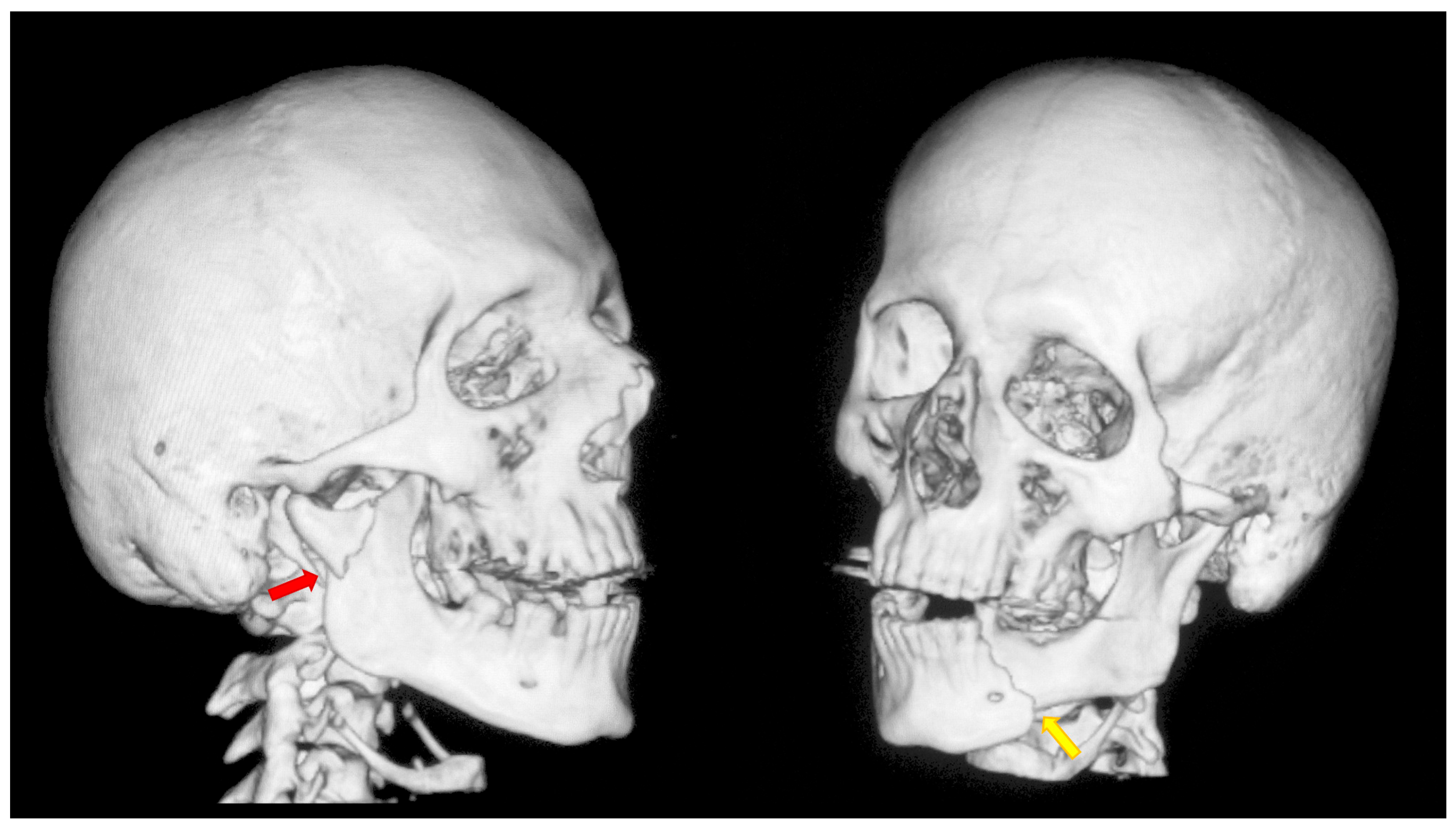 Dentistry 13 00562 g001 Dentistry 13 00562 g001